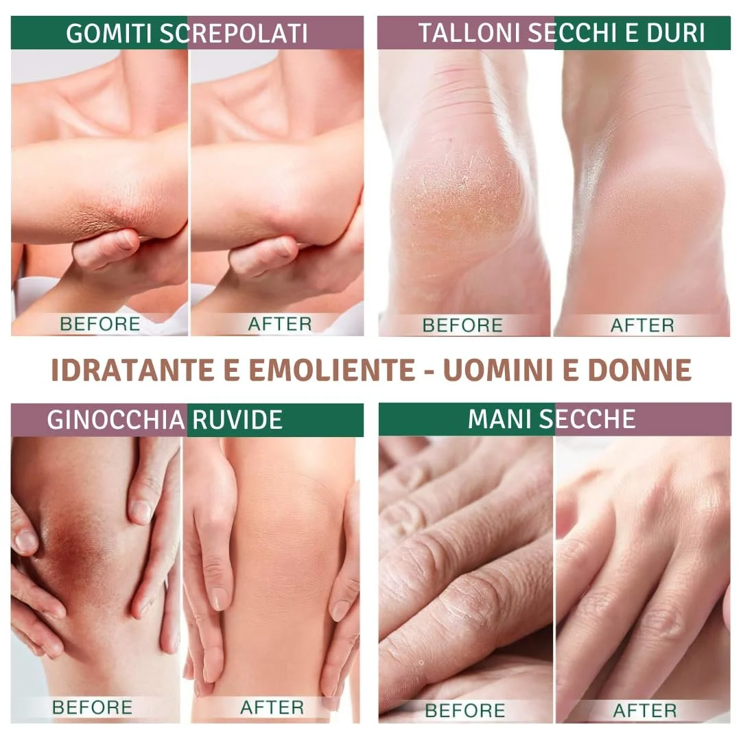 Крем для ног Eladerm с мочевиной 30% 100 мл, фото №6 Крем для ног Eladerm с мочевиной 30% 100 мл, фото №6