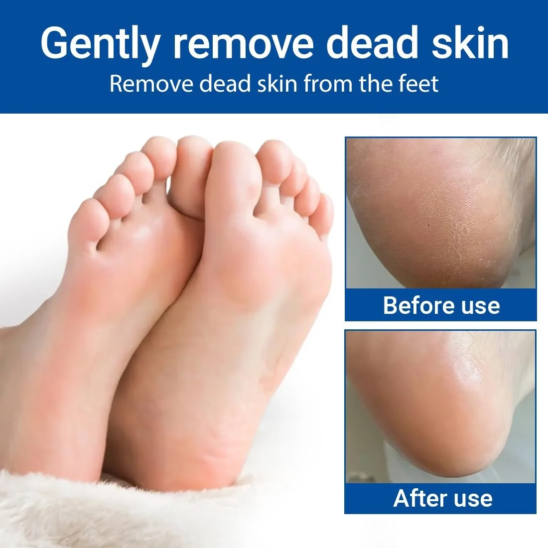 Крем для ног Urea Cream 60%, 2 шт., фото №4 Крем для ног Urea Cream 60%, 2 шт., фото №4