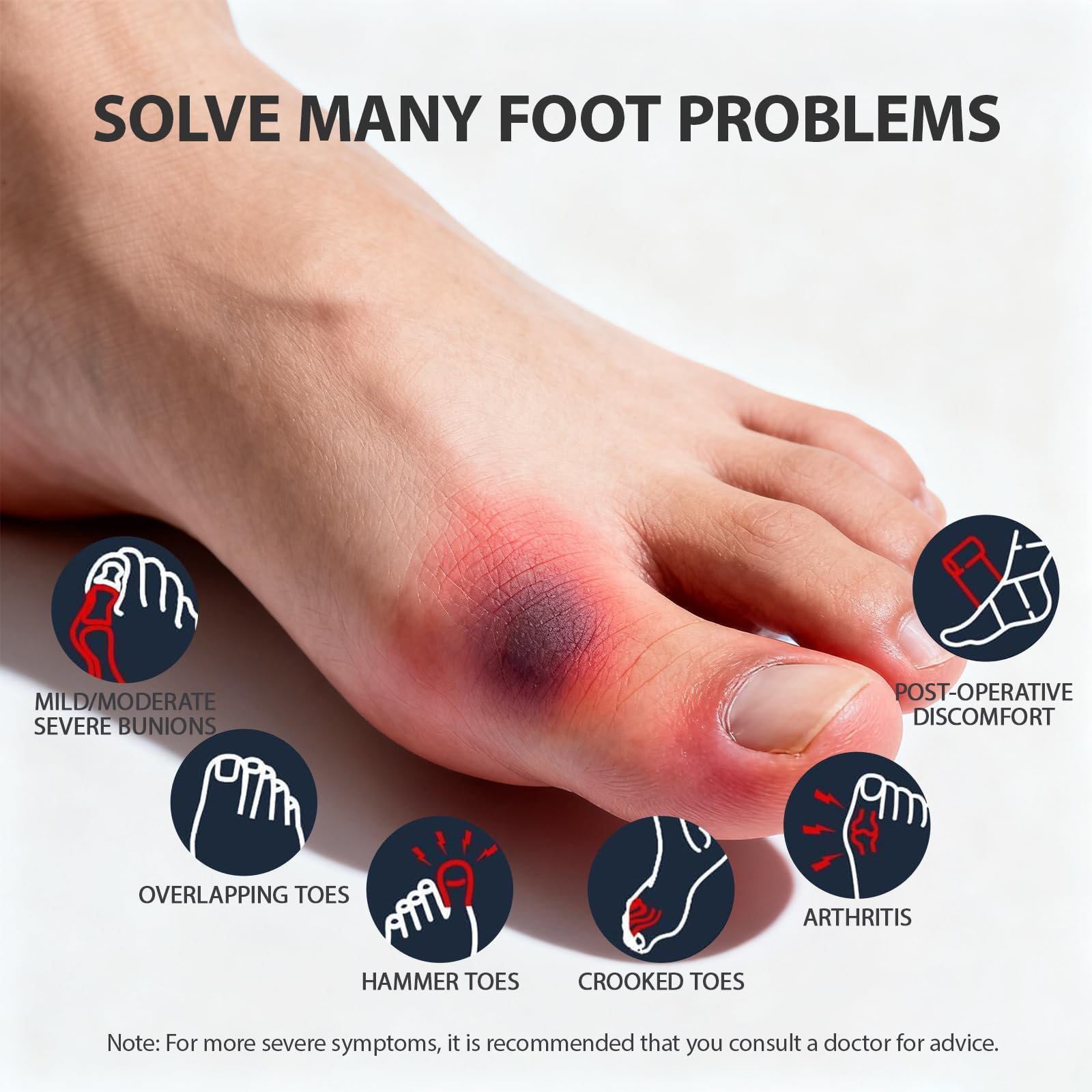 Шина для коррекции Hallux Valgus Регулируемая Облегчение боли и защита Корректирующая, фото №5