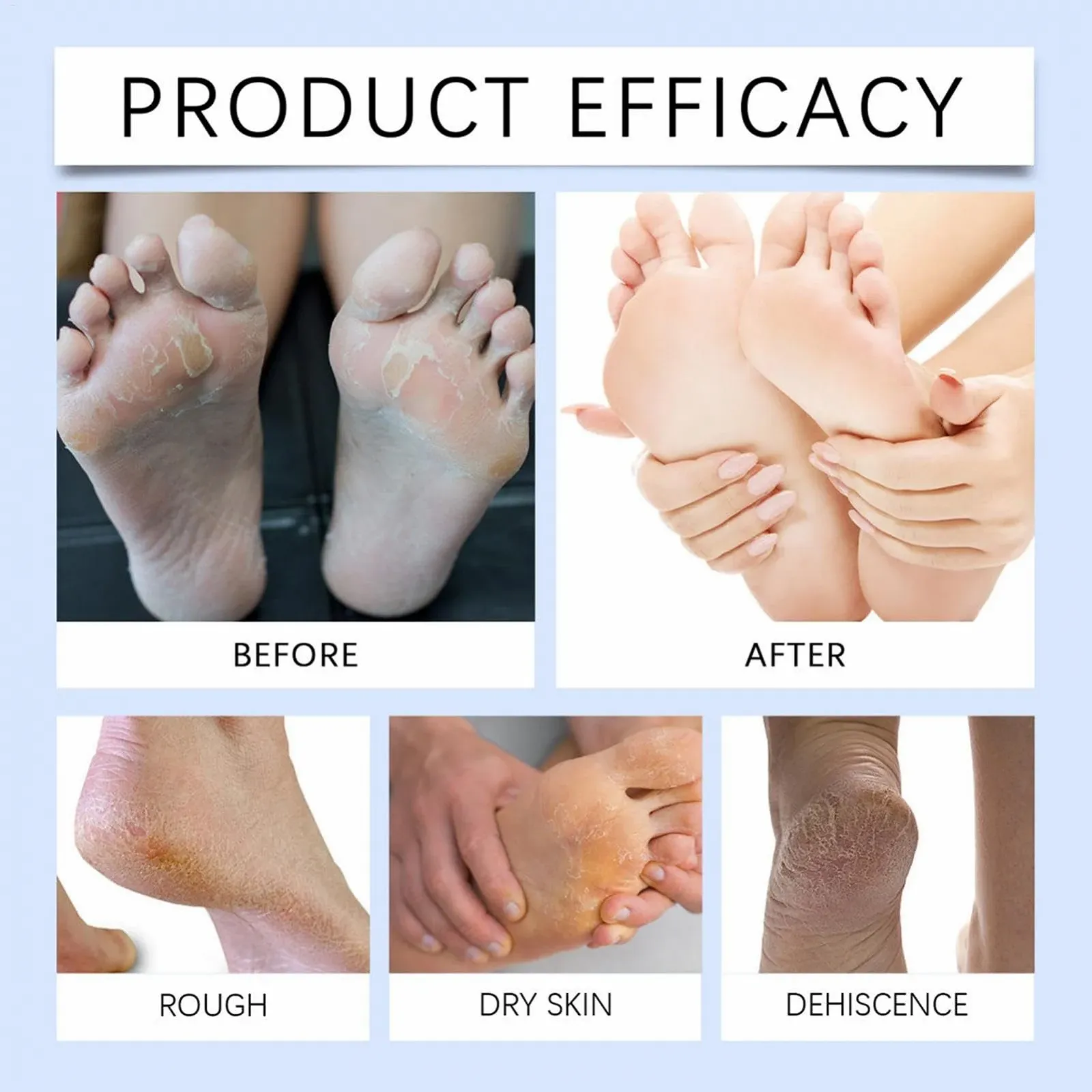Крем-бальзам для ног Foot Repair Balm увлажняющий для сухих и потрескавшихся пяток, фото №4