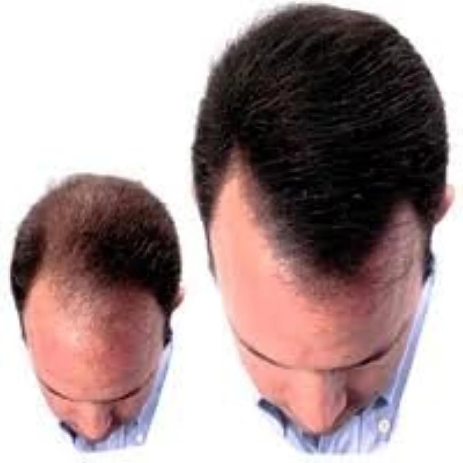 Волокна для волосся Beaver KERATIN для маскування залисин 28г Темно-коричневий, фото №5 Волокна для волосся Beaver KERATIN для маскування залисин 28г Темно-коричневий, фото №5