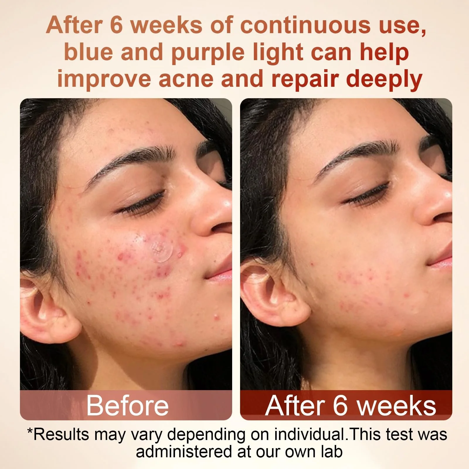 LED Маска для обличчя Rkdely Лампа червоного світла для обличчя: 4 кольори, фото №3