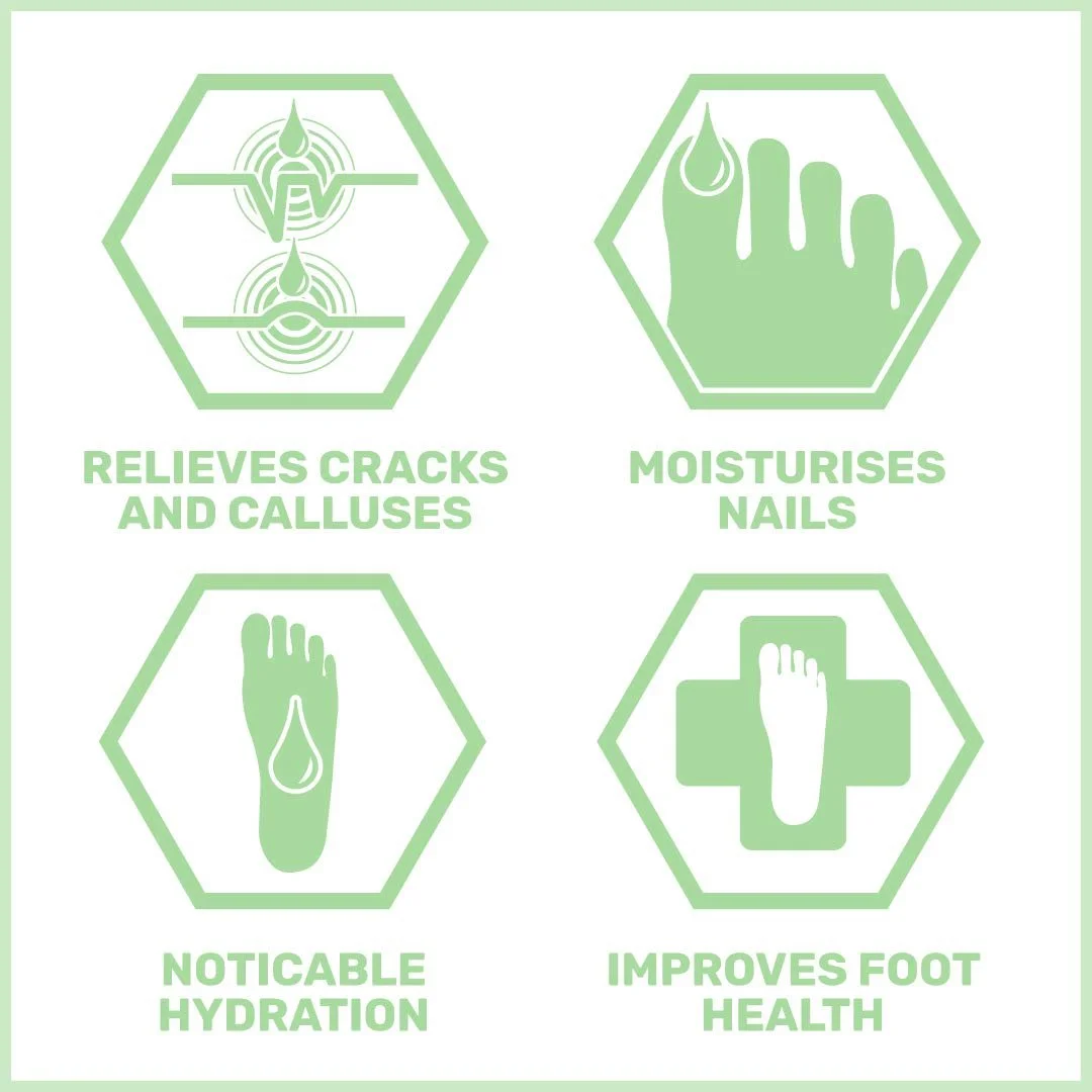 Бальзам для потрескавшихся пяток Sebamed 75 мл, фото №2