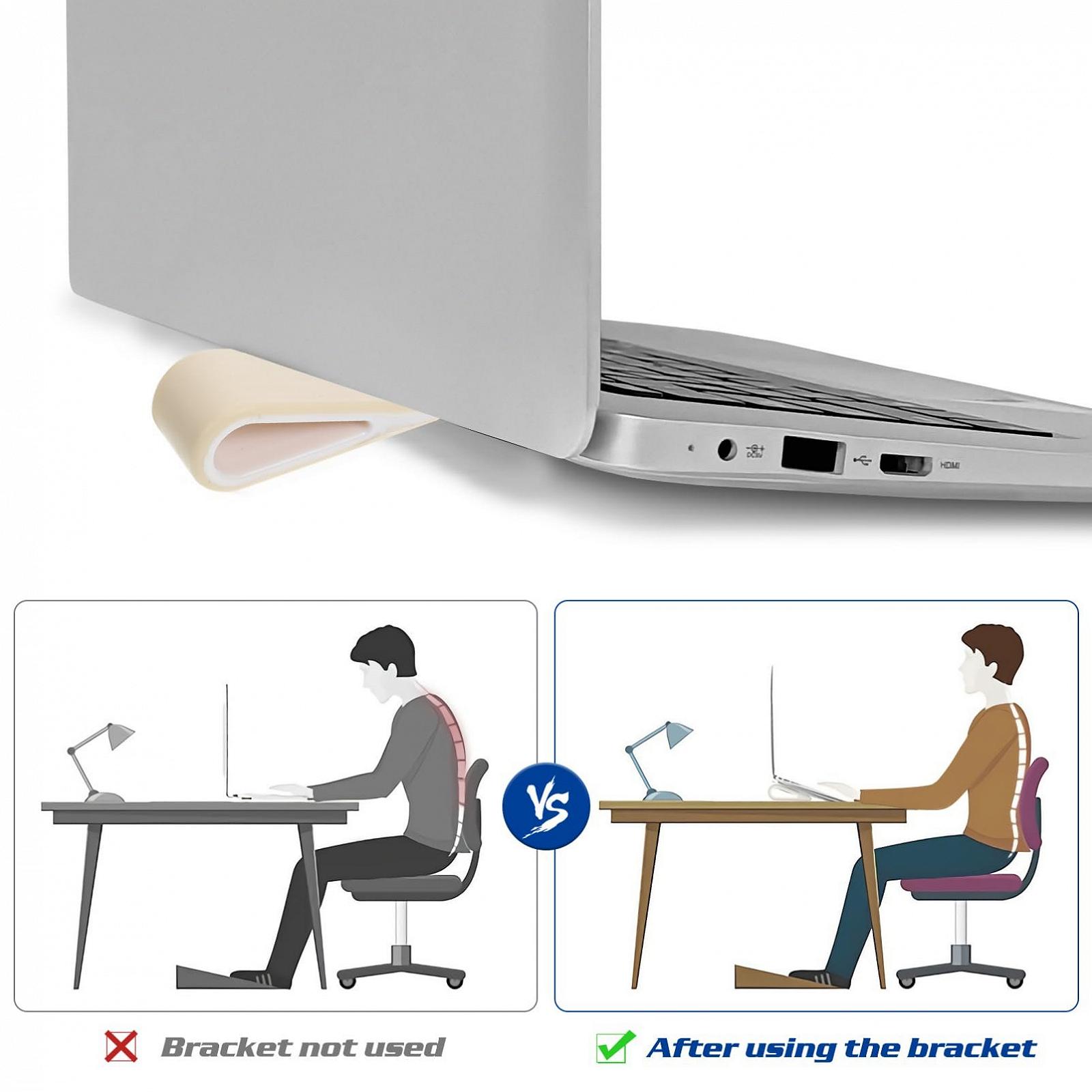 Подставка для ноутбука Силиконовая Портативная Эргономичная Белая (2 шт.), фото №7 Подставка для ноутбука Силиконовая Портативная Эргономичная Белая (2 шт.), фото №7