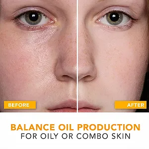 Зволожуючий крем для обличчя Organic & Natural Daily Face Moisture Cream для чутливої, жирної або комбінованої шкіри ціна на synthetic.ua - Фото 1 Зволожуючий крем для обличчя Organic & Natural Daily Face Moisture Cream для чутливої, жирної або комбінованої шкіри synthetic.ua - Фото 1
