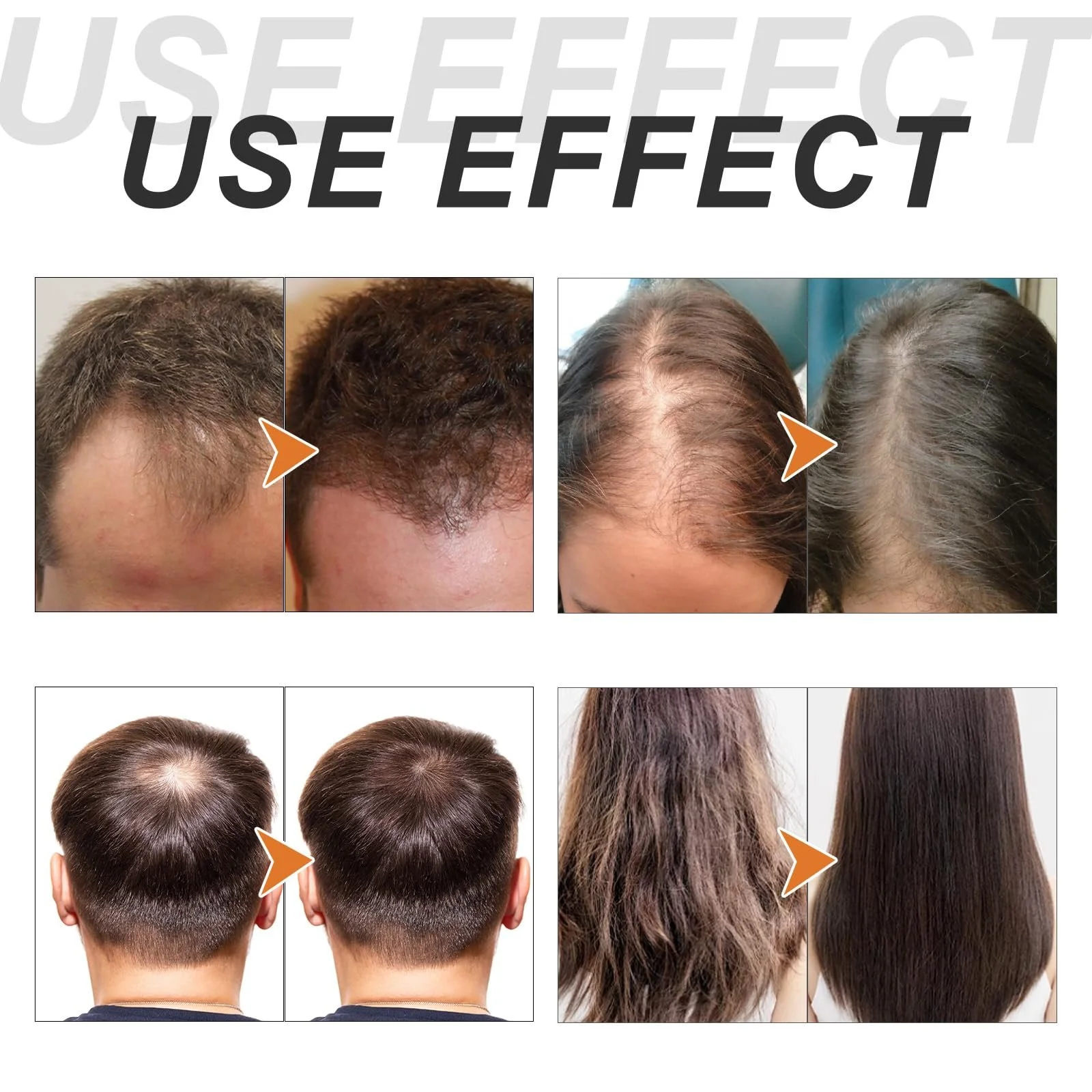 Сироватка для волосся Проти випадіння волосся 2 шт Чорний, фото №2