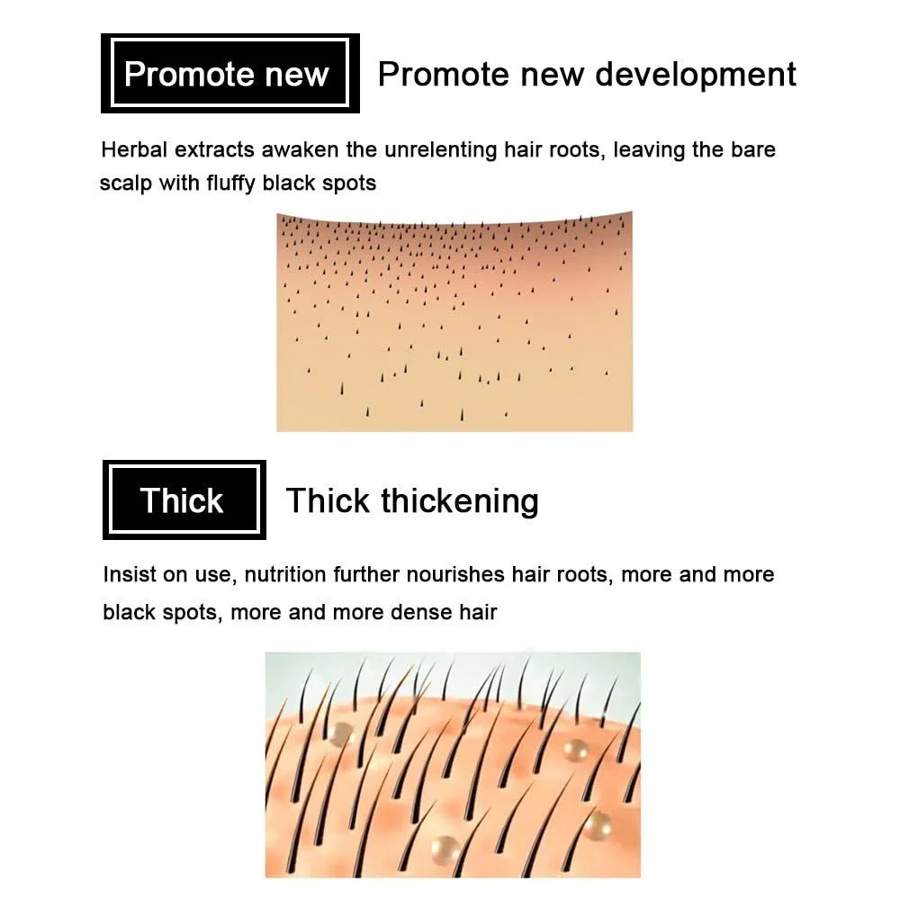 Сироватка для росту волосся 7 Days, імбирна, засіб проти випадіння волосся для чоловіків і жінок, фото №7 Сироватка для росту волосся 7 Days, імбирна, засіб проти випадіння волосся для чоловіків і жінок, фото №7