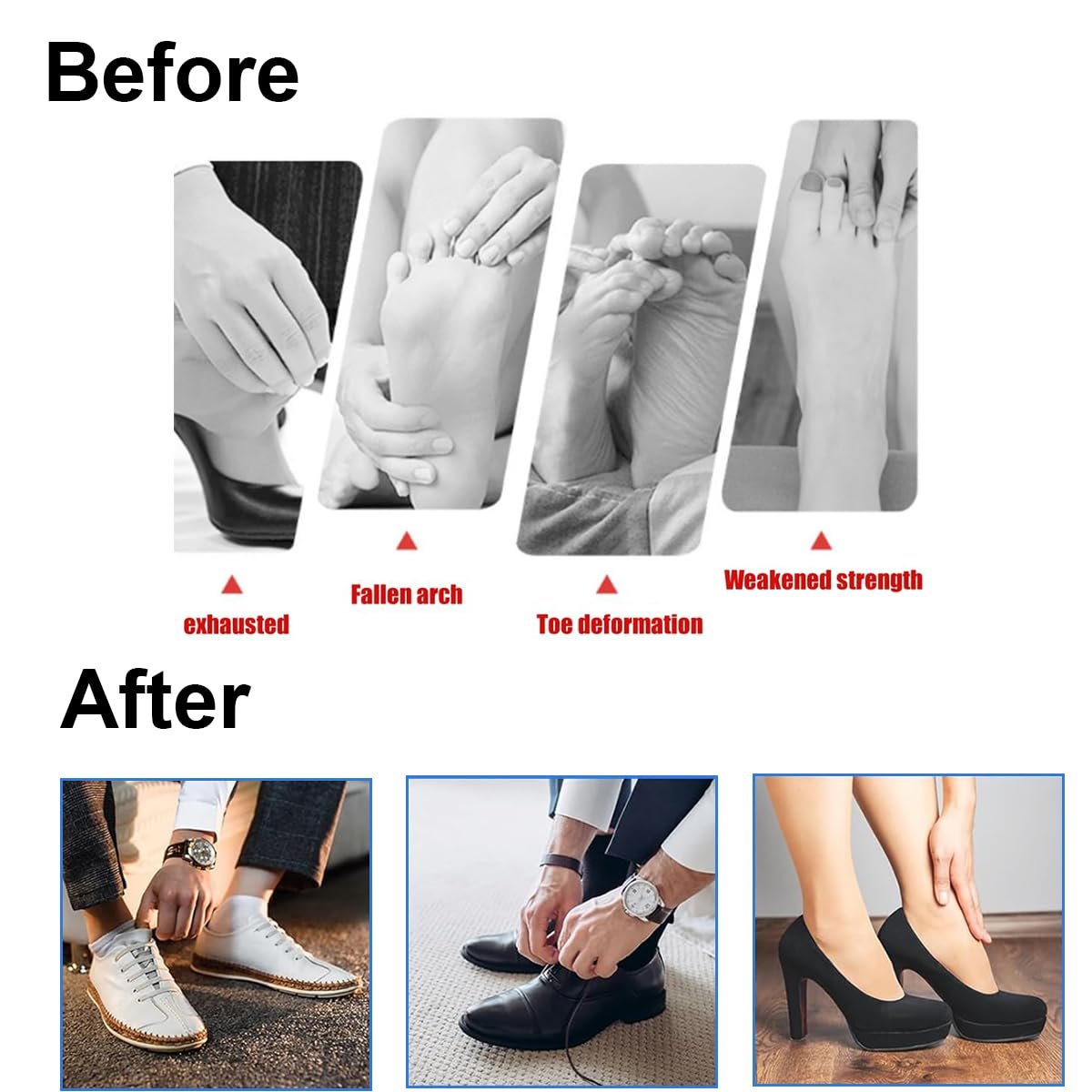 Шкарпетки для корекції великого пальця стопи Hallux Valgus, 1 пара коректорів, фото №6 Шкарпетки для корекції великого пальця стопи Hallux Valgus, 1 пара коректорів, фото №6