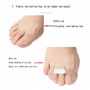 Шина для молоткоподібних пальців Тканинна шина Роздільник для пальців synthetic.ua - Фото 1