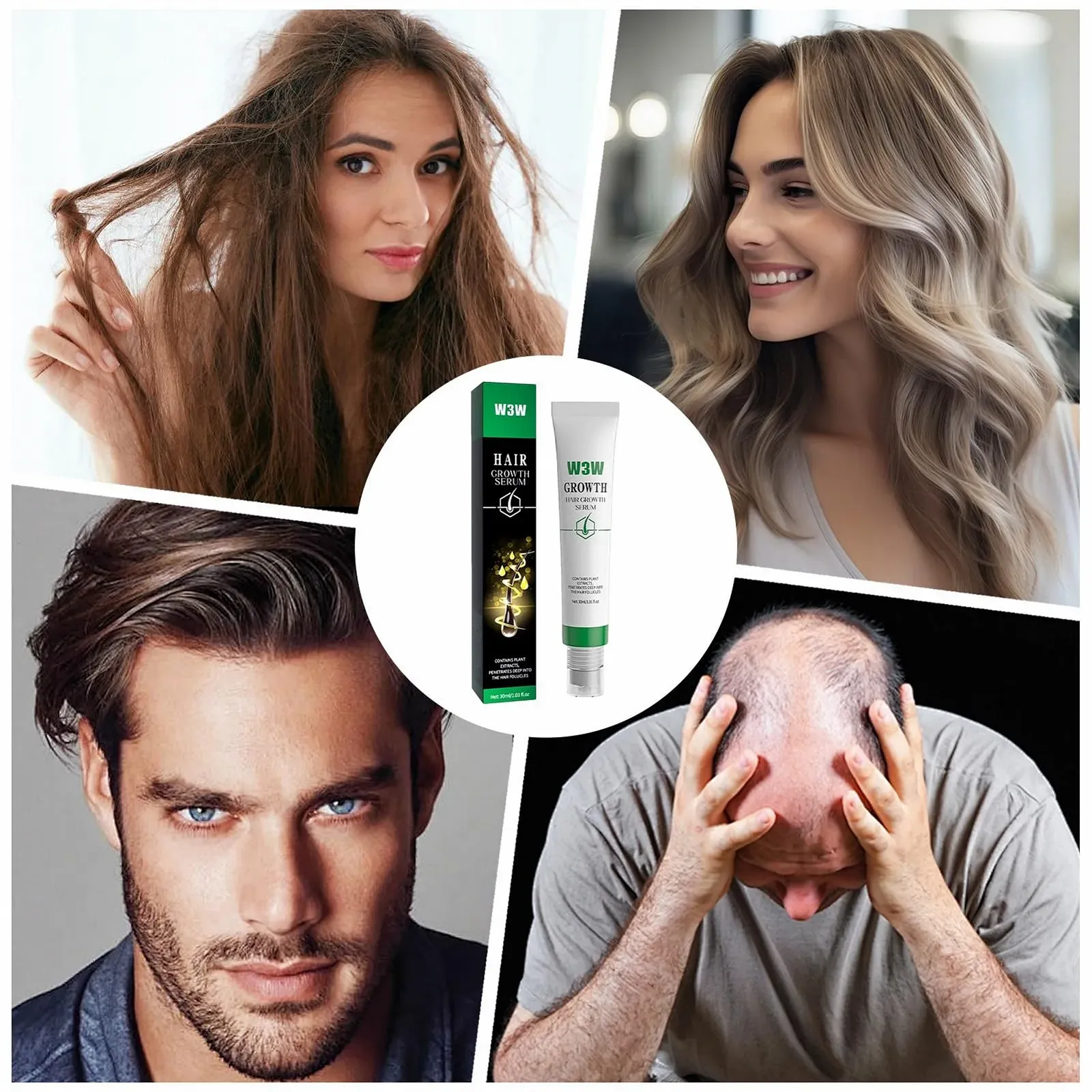 Олія для росту волосся Iouyjiu, органічна, зволожуюча, зміцнює коріння, фото №9 Олія для росту волосся Iouyjiu, органічна, зволожуюча, зміцнює коріння, фото №9