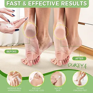 Крем с мочевиной OUKEYA 40% с 2% салициловой кислотой 150 г synthetic.ua - Фото 1