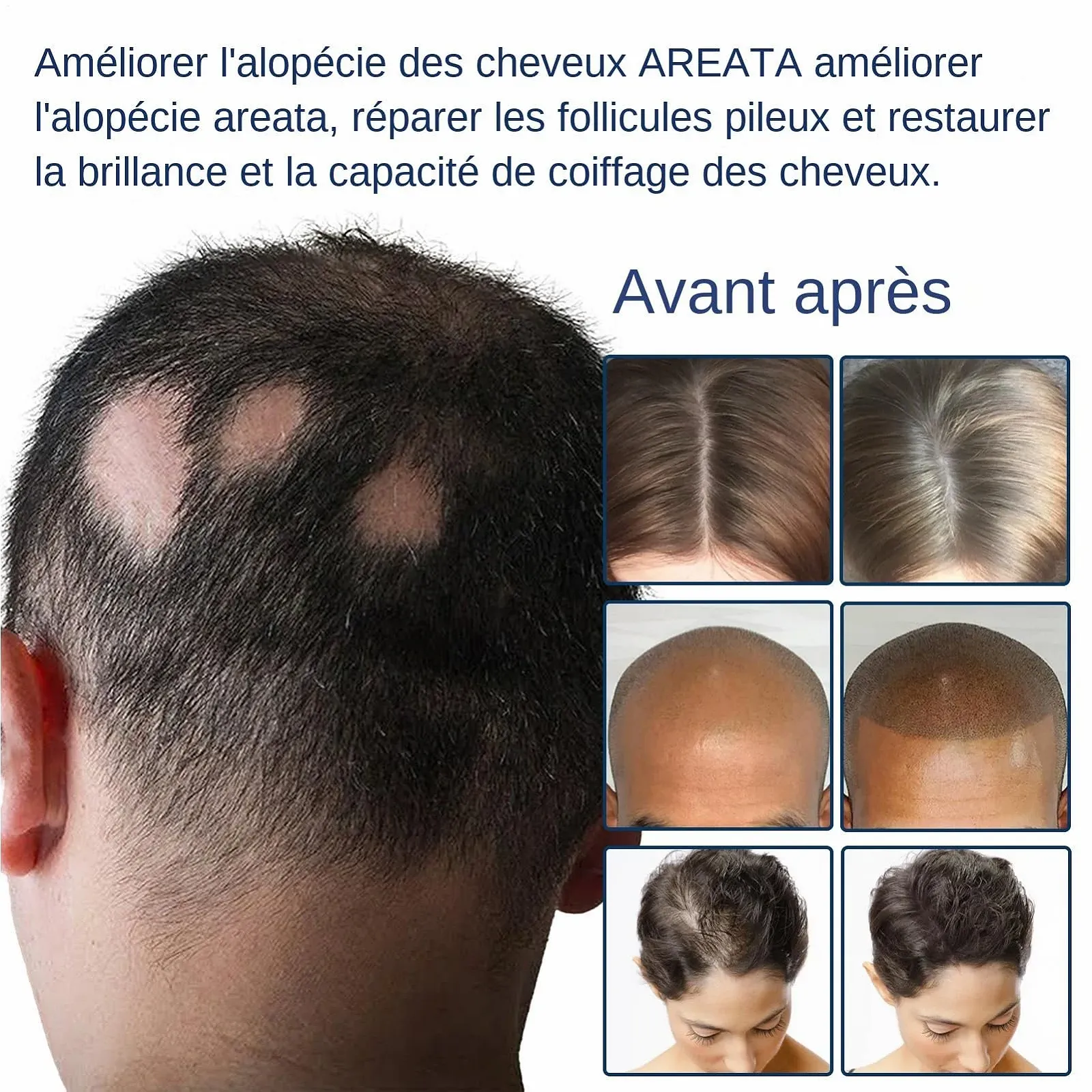 Крем для росту волосся Mimoqk, 20 г, натуральний крем для потовщення волосся, легка зволожуюча паста, фото №5