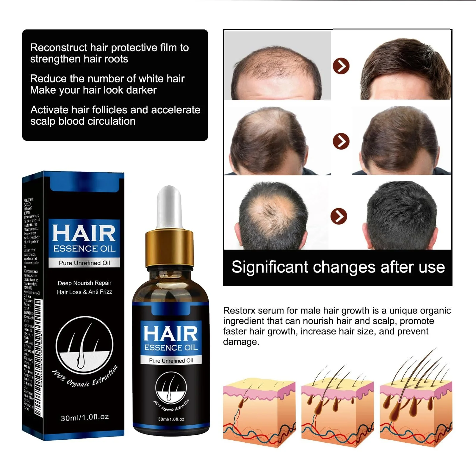 Сироватка KOAHDE для росту волосся проти випадіння, есенція олії для росту волосся, фото №6 Сироватка KOAHDE для росту волосся проти випадіння, есенція олії для росту волосся, фото №6