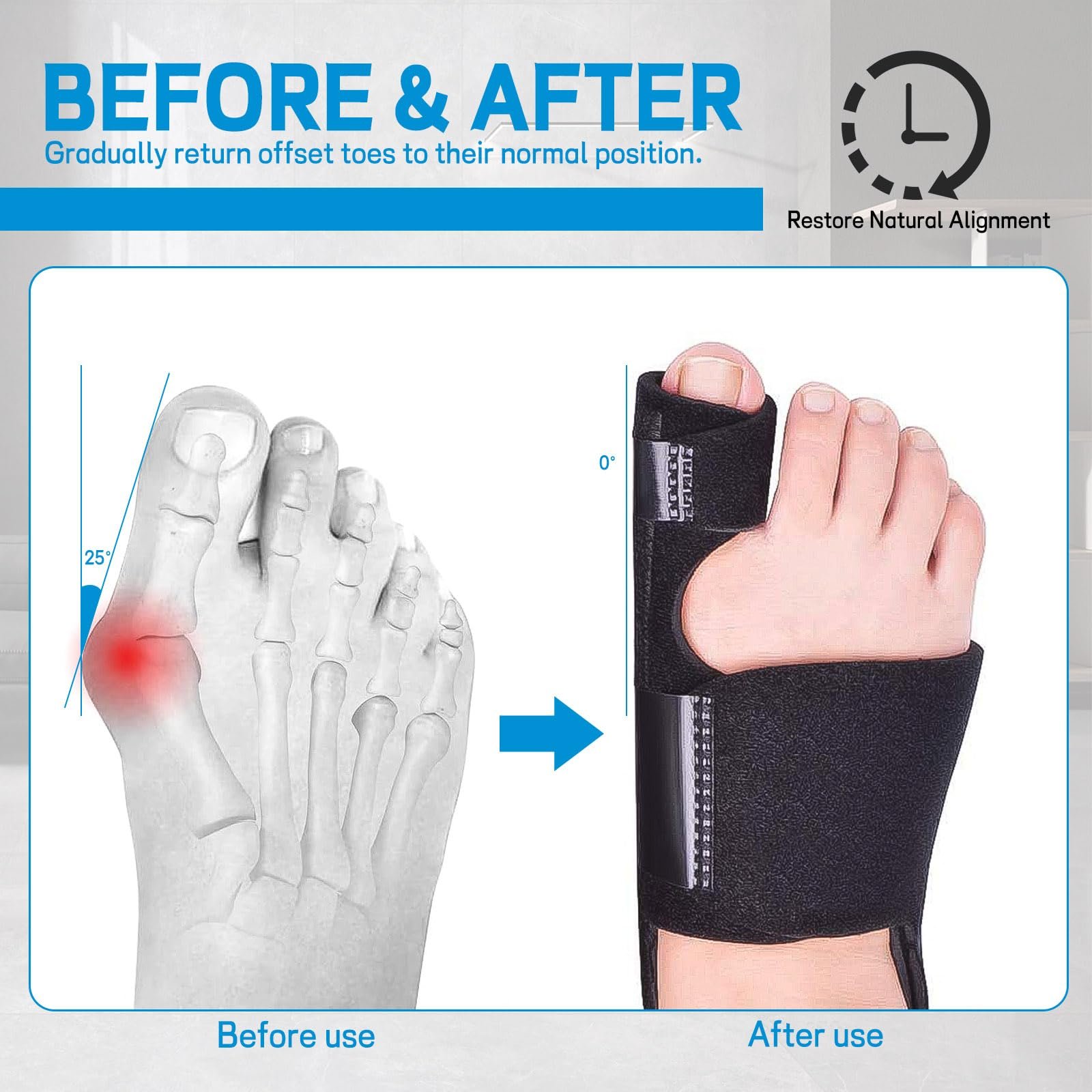 Набір для корекції Hallux Valgus, фото №3