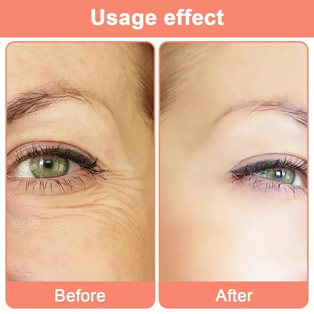 Пластирі від зморшок OUDQFCJ, 8 шт., фото №4 Пластирі від зморшок OUDQFCJ, 8 шт., фото №4