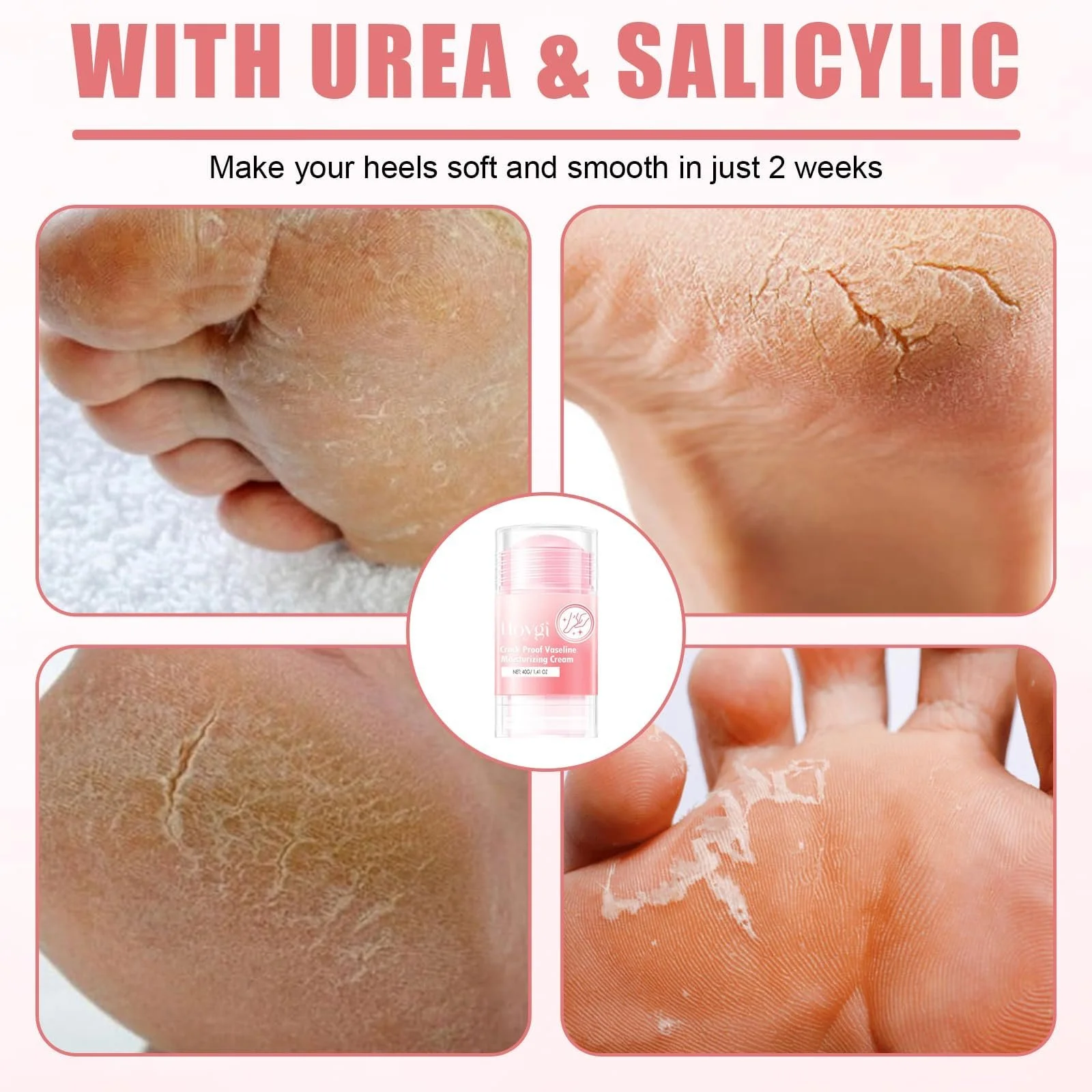 Крем для ног Update увлажняющий от мозолей и трещин для очень сухой кожи, фото №3