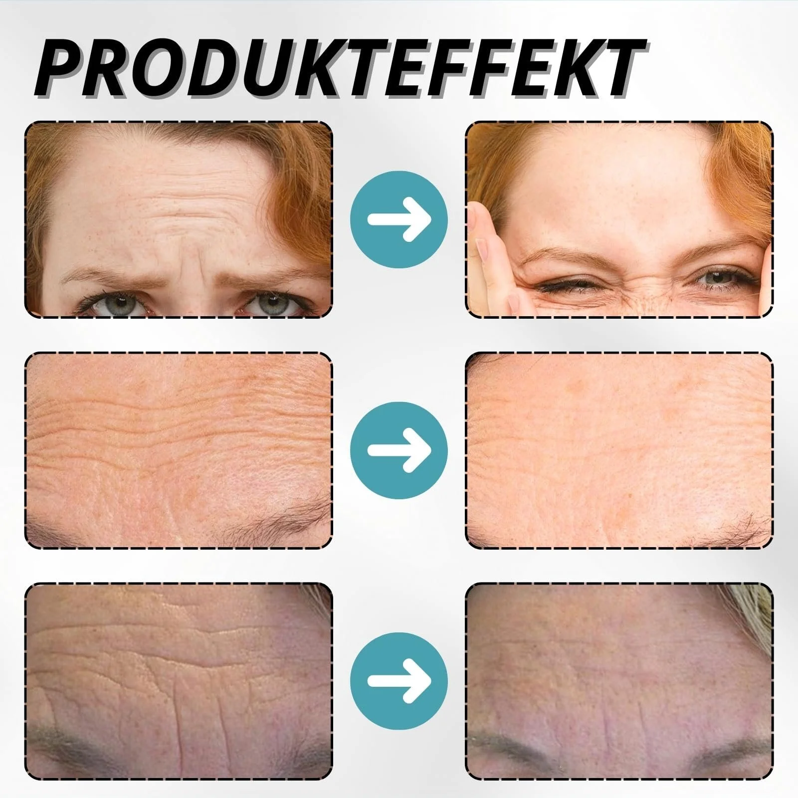 Пластирі від зморшок на лобі, 30 шт, Hydrogel Face Tape Lifting Face, колагенові антизморшкові пластирі, фото №5