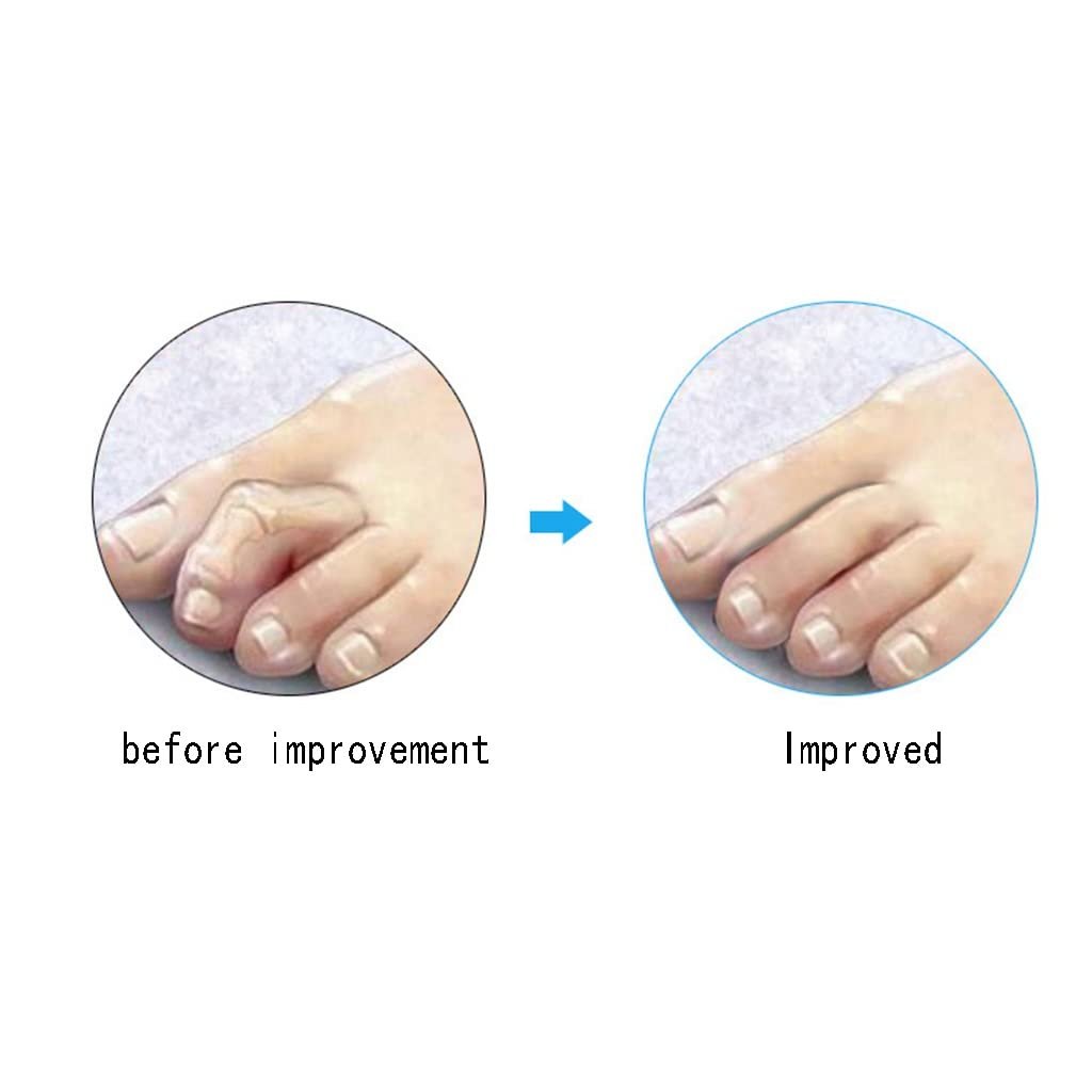 Разделитель для пальцев ног, силиконовый, фото №8