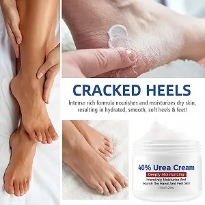 Крем для ног с 40% мочевиной для сухой кожи, потрескавшихся пяток и удаления мозолей synthetic.ua - Фото 1
