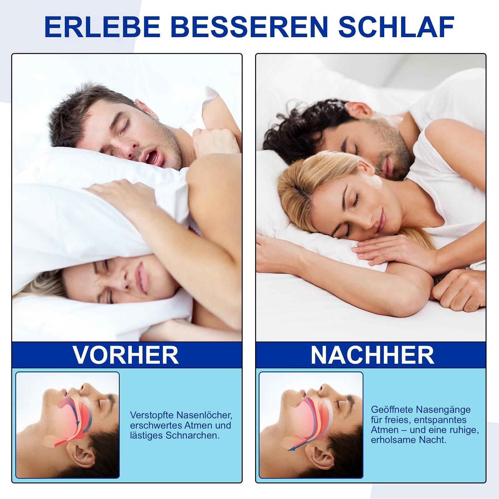 Пластирі для носа P-Beauty Refill Pack 70 шт (на 35 днів) для магнітної стрічки Набір змінних пластирів для носа, фото №5 Пластирі для носа P-Beauty Refill Pack 70 шт (на 35 днів) для магнітної стрічки Набір змінних пластирів для носа, фото №5