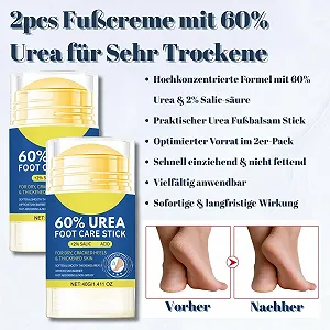 Крем для ног Urea 60% для очень сухой и потрескавшейся кожи с 2% салициловой кислотой стик бальзам (2*40 г) цена на synthetic.ua - Фото 1 Крем для ног Urea 60% для очень сухой и потрескавшейся кожи с 2% салициловой кислотой стик бальзам (2*40 г) synthetic.ua - Фото 1