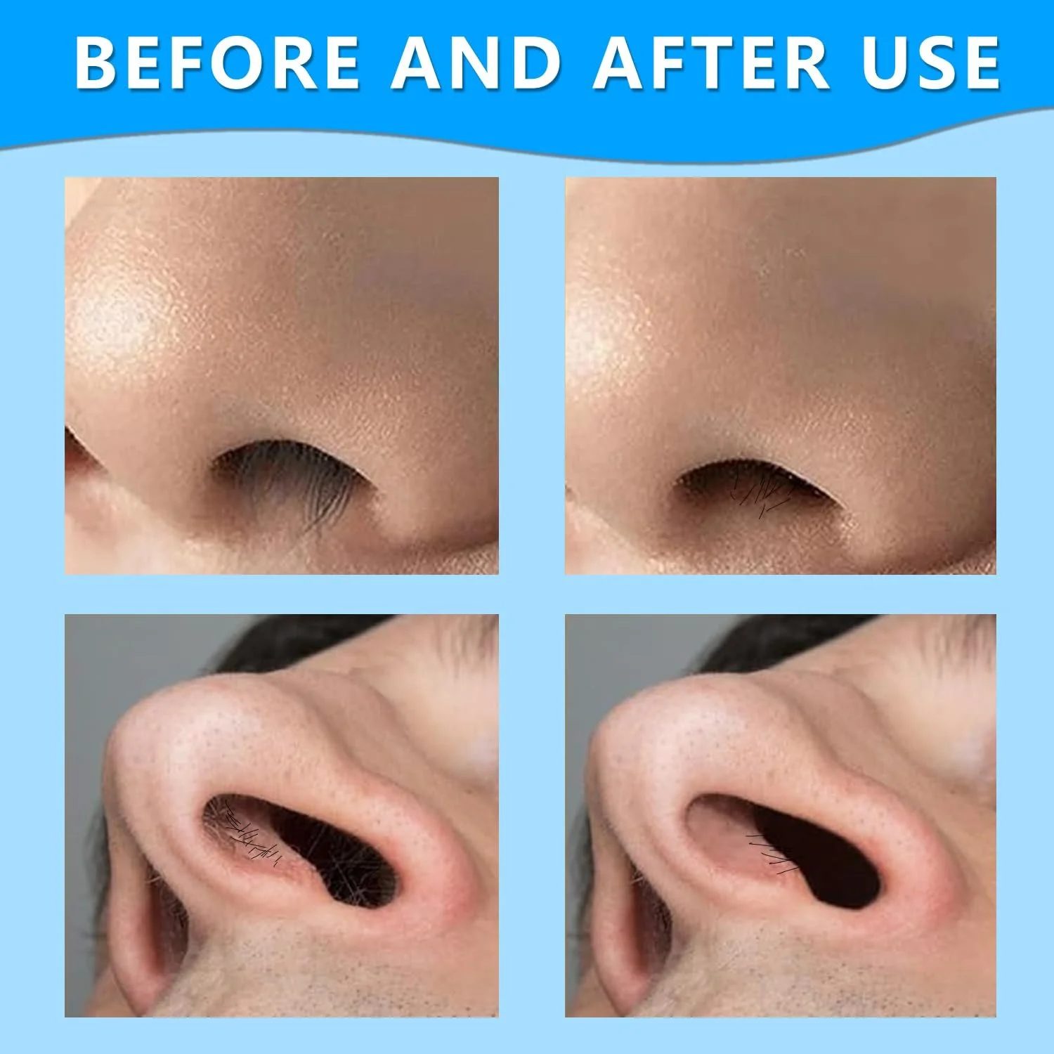 Тример для носа Pack 2 in 1 Hair Trimmer Double Sided Машинка для видалення волосся Настрій для жінок та чоловіків, фото №5