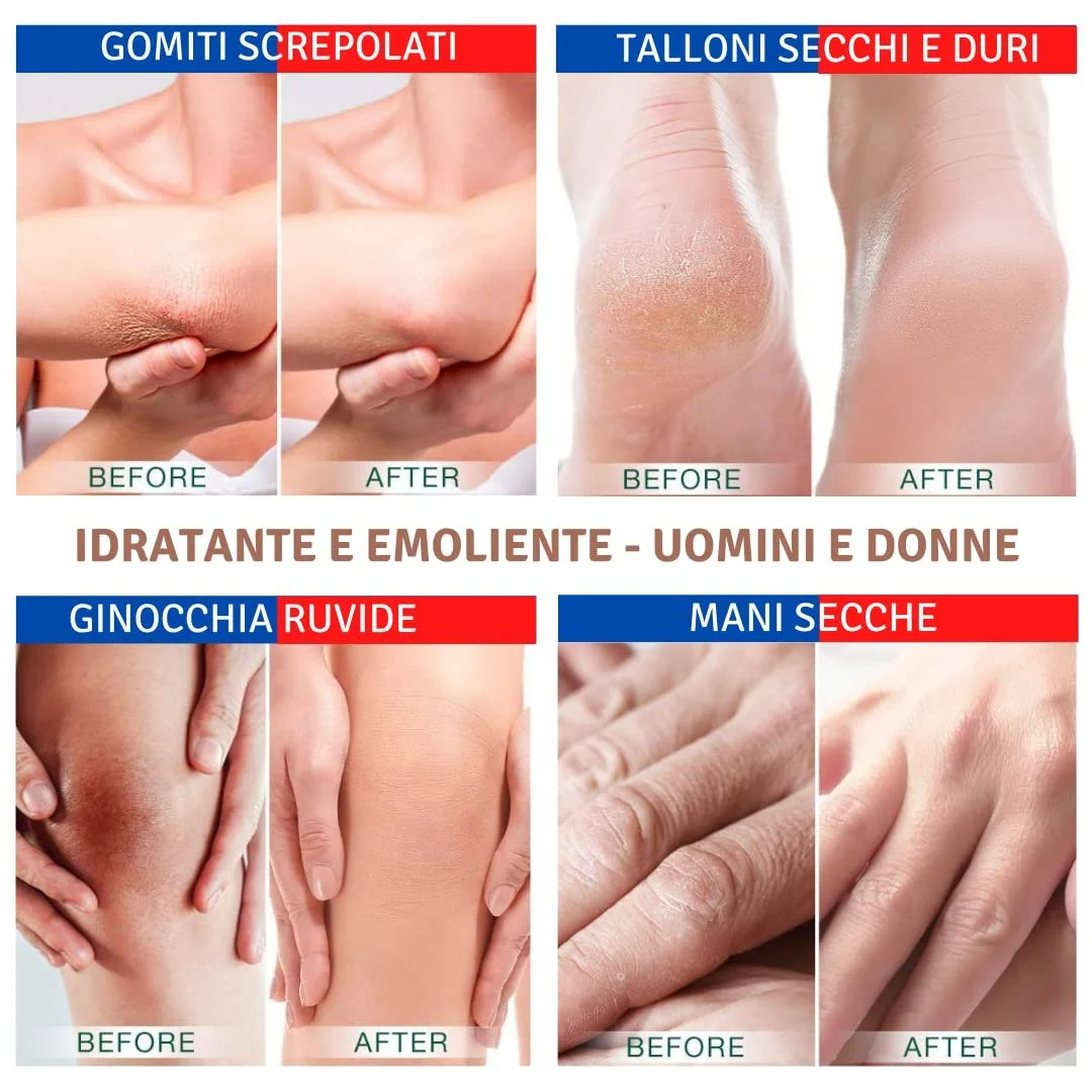 Крем для ног TIS Urea 15% с молочной кислотой AHA и зародышами пшеницы, фото №3