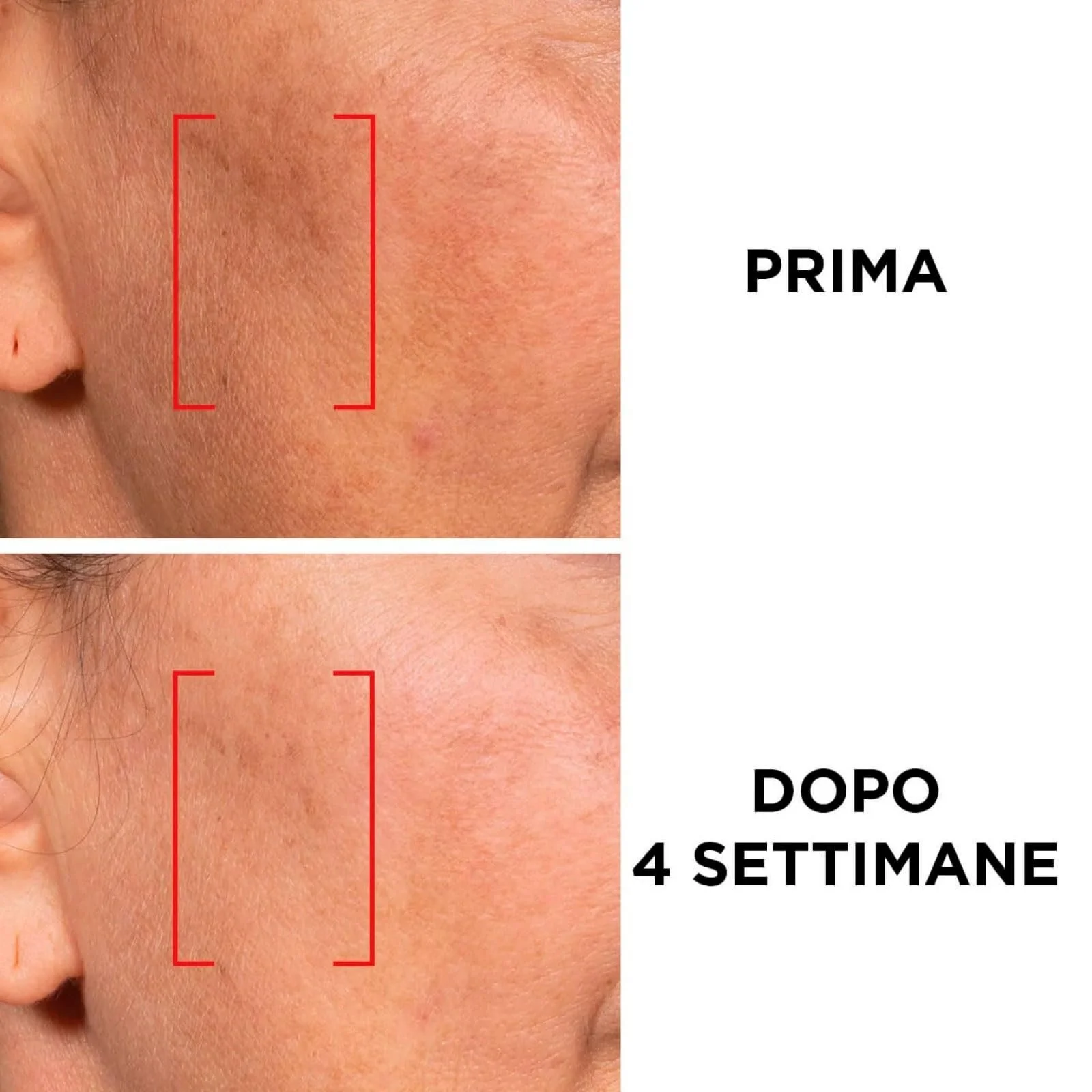 Денний крем L'Oréal Paris Revitalift Laser X3 антивіковий із SPF 25 з гіалуроновою кислотою, про-ретинолом та вітаміном C 50 мл, фото №2 Денний крем L'Oréal Paris Revitalift Laser X3 антивіковий із SPF 25 з гіалуроновою кислотою, про-ретинолом та вітаміном C 50 мл, фото №2