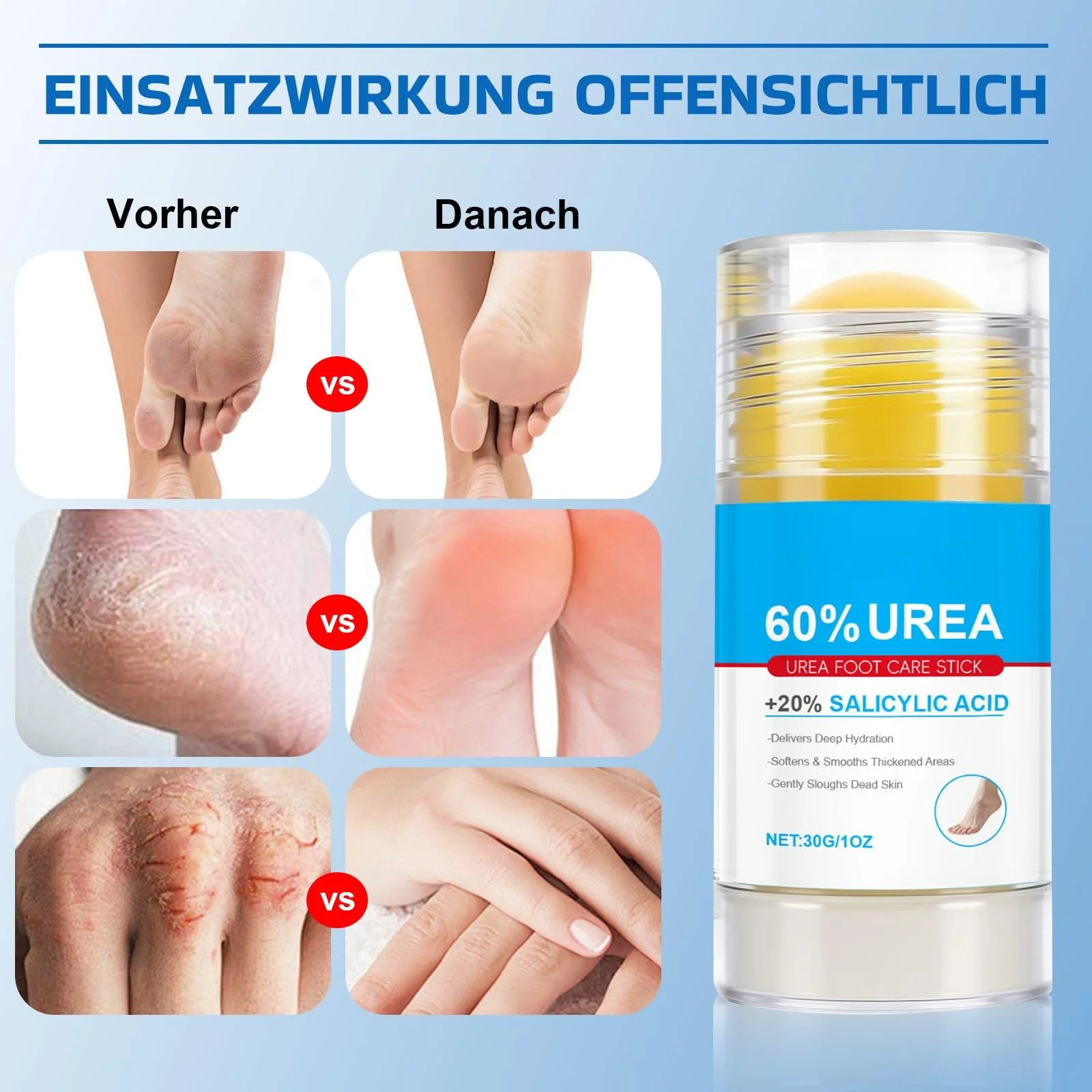 Набор Urea Cream 60% + Body Lotion крем для ног и лосьон для тела интенсивный уход, фото №3 Набор Urea Cream 60% + Body Lotion крем для ног и лосьон для тела интенсивный уход, фото №3