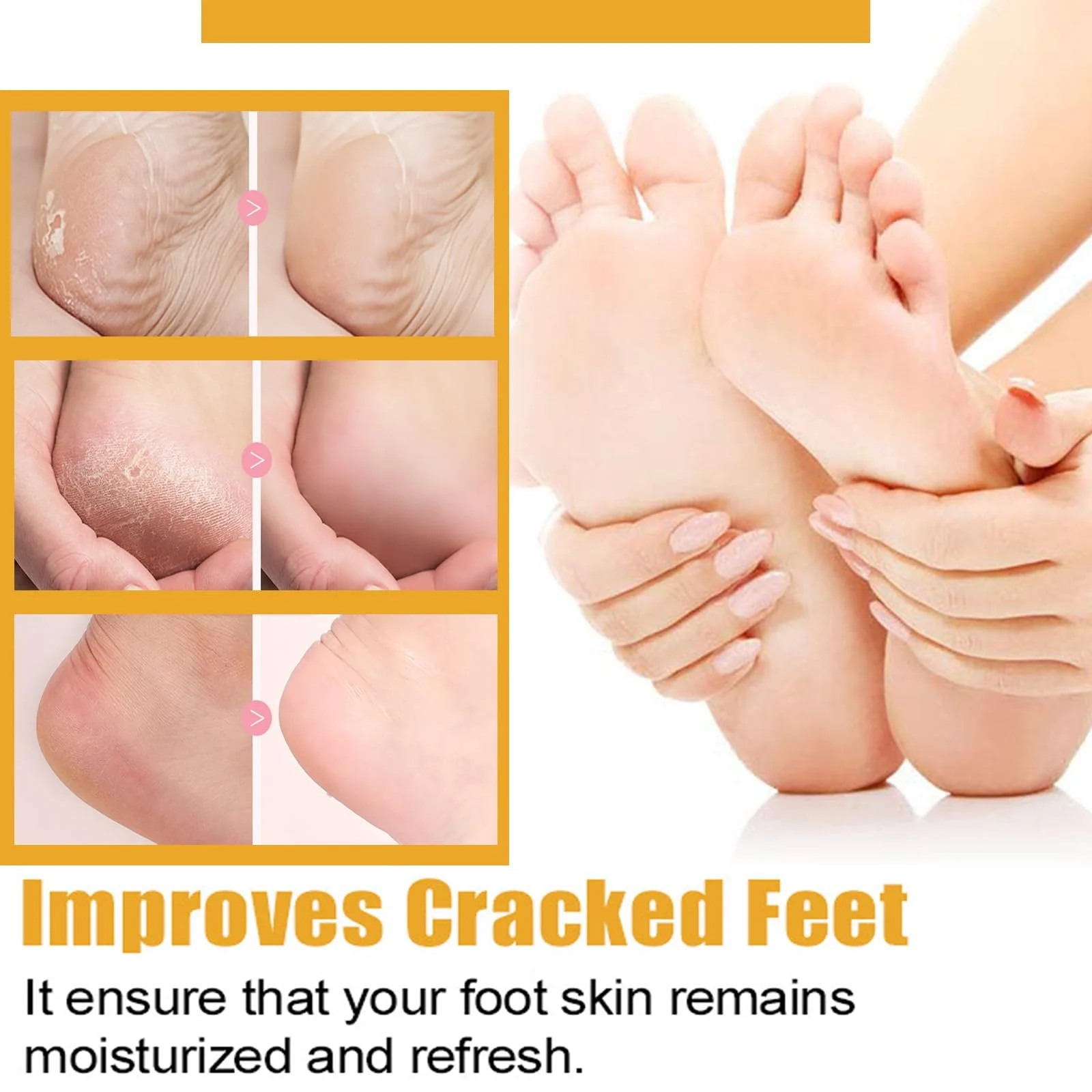 Крем для ног с мочевиной Urea Cream 60% увлажняющий и восстанавливающий против трещин для сухих стоп и рук, фото №7