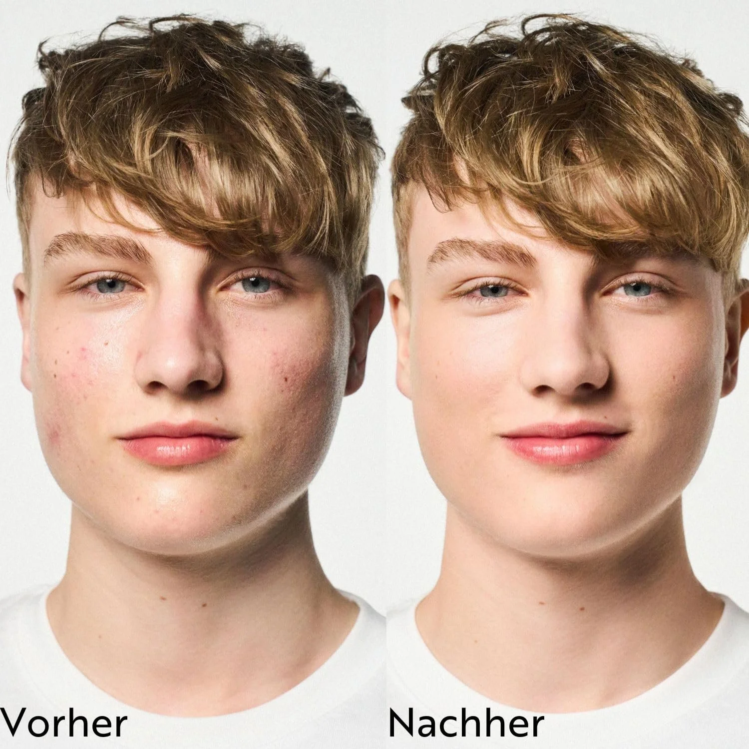 Маска для обличчя M. Asam Clear Skin Очищуюча 100 мл, фото №5 Маска для обличчя M. Asam Clear Skin Очищуюча 100 мл, фото №5