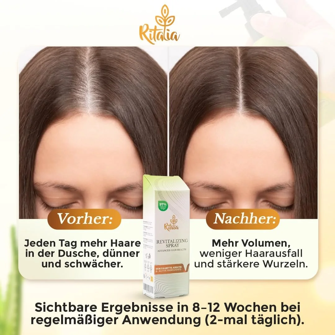 Спрей Ritalia для росту волосся з Saw Palmetto, сироватка для росту волосся для чоловіків та жінок, фото №3