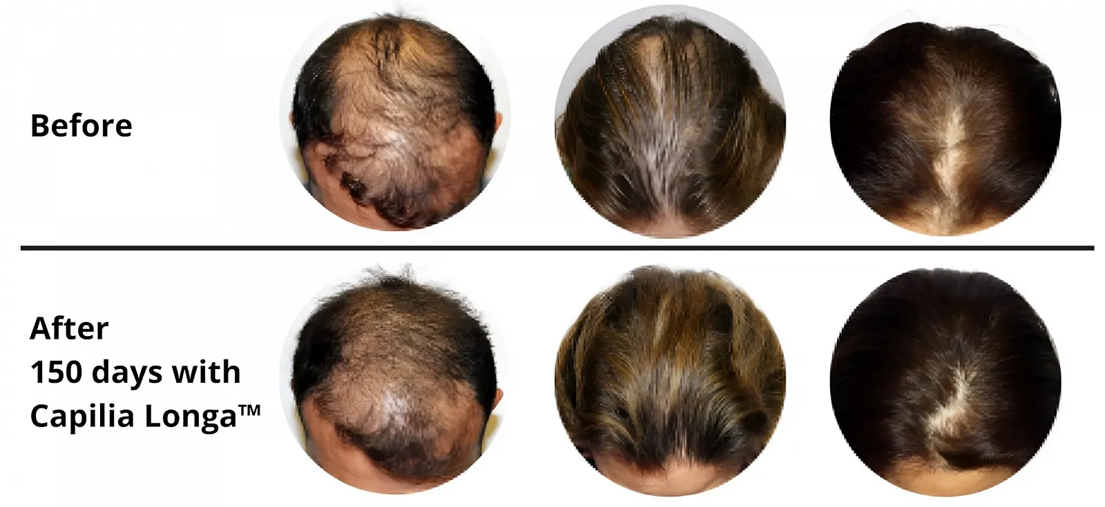 Сироватка для росту волосся Sattva Ayurveda з екстрактом розмарину та Redensyl для лікування випадіння волосся у жінок та чоловіків, фото №6 Сироватка для росту волосся Sattva Ayurveda з екстрактом розмарину та Redensyl для лікування випадіння волосся у жінок та чоловіків, фото №6