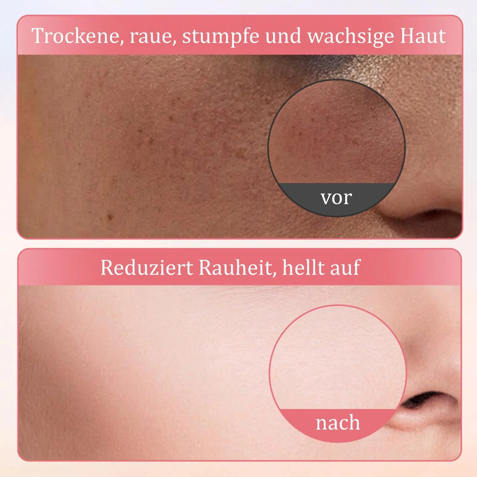 Маска для обличчя Soleneva з рожевою сіллю - 6 штук Зволожуюча маска для обличчя з центеллою та гіалуроновою кислотою, фото №6