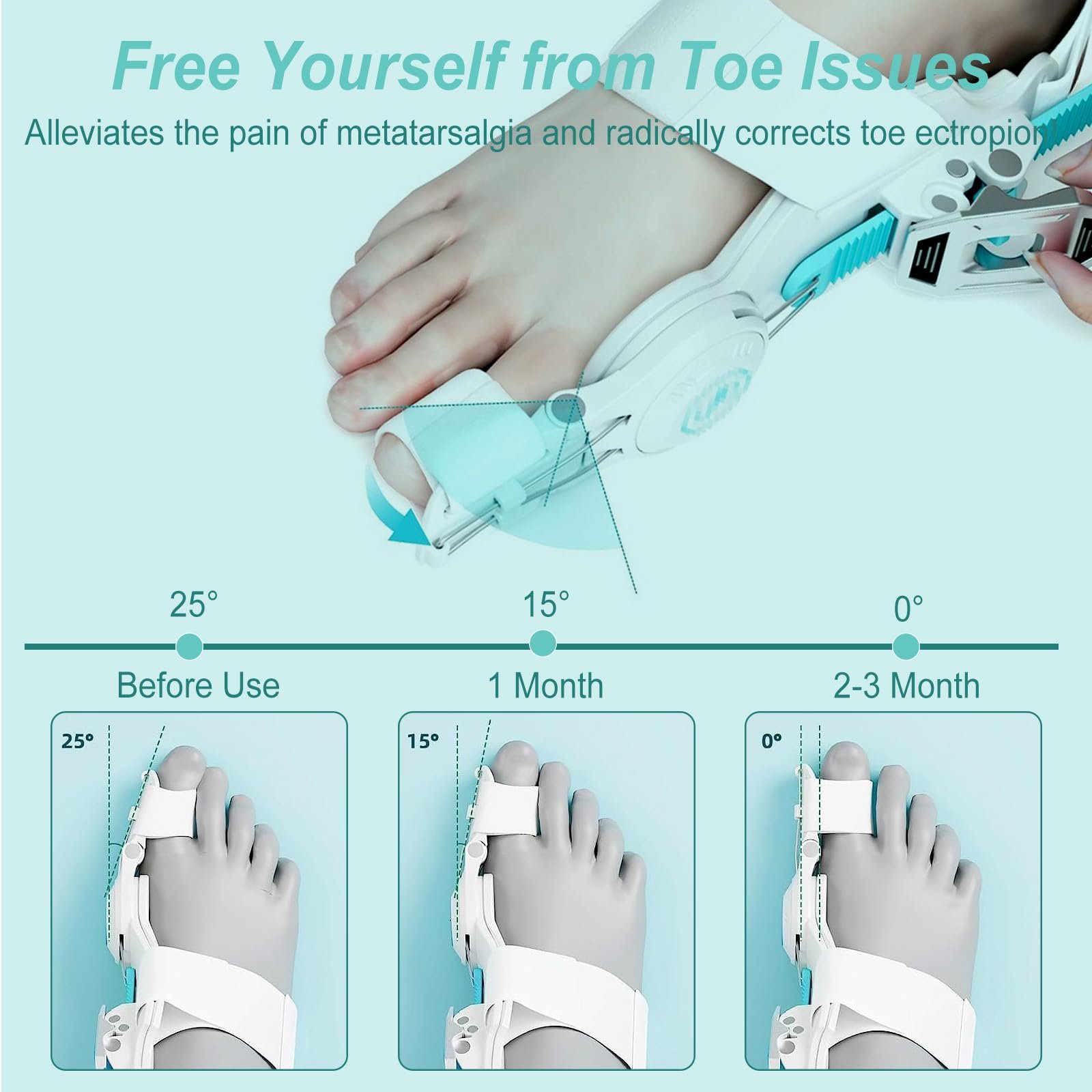 Коректор великого пальця стопи з регульованою кнопкою Hallux Valgus, 1 шт., унісекс, фото №4 Коректор великого пальця стопи з регульованою кнопкою Hallux Valgus, 1 шт., унісекс, фото №4