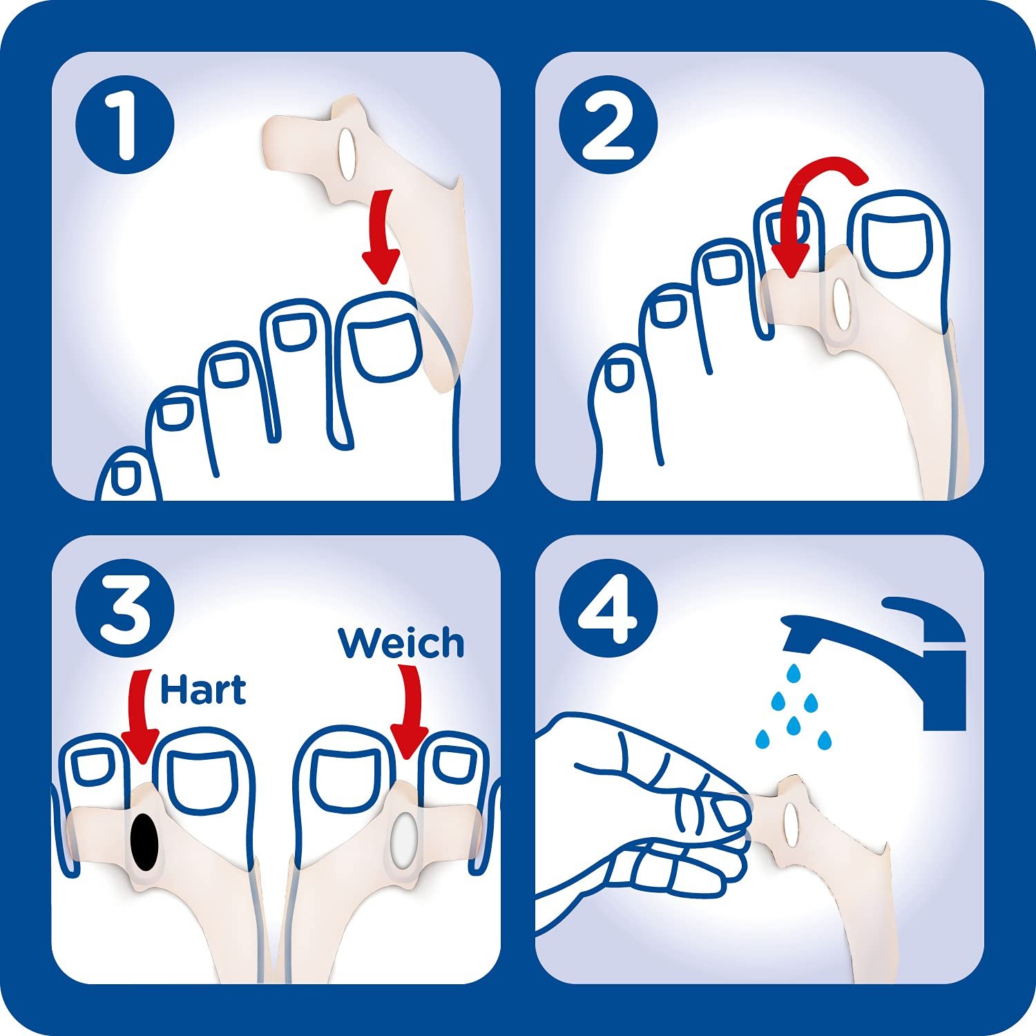 Защита от давления 2-в-1 Hallux Valgus Plus Burgit, 4 гелевые подушечки + 6 клиньев, фото №5