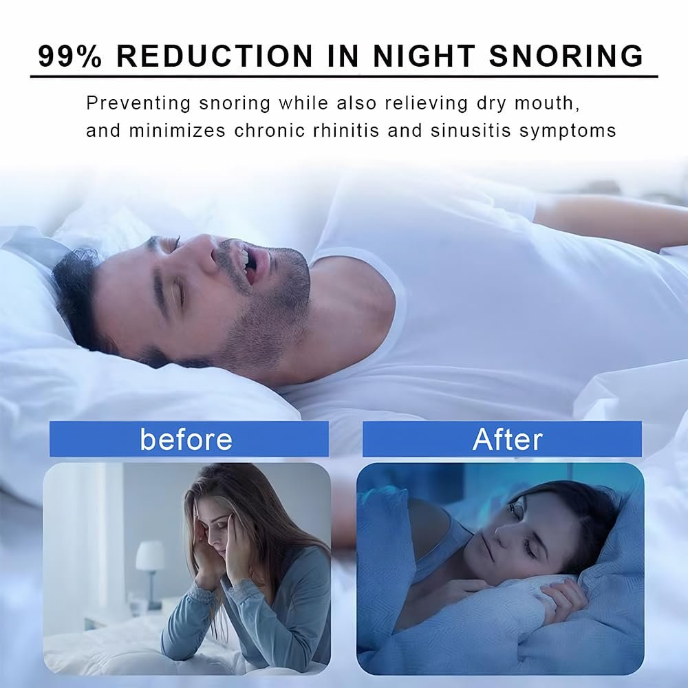 Смужки для сну 30 шт. Високоякісні від хропіння для носа для кращого сну, дихаючі та приємні для шкіри пластирі для носа, фото №7