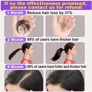 Сыворотка GoldWorld для роста волос с розмарином, 2 шт. Массажер для кожи головы, биотин, аргановое масло и касторовое масло для истонченных, сухих и поврежденных волос synthetic.ua - Фото 1