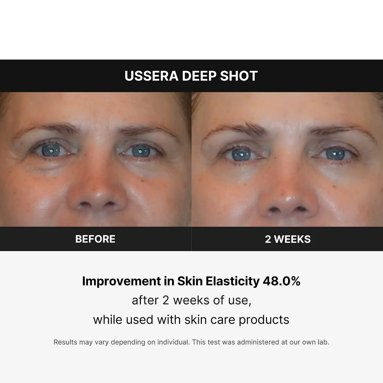 Прилад для догляду за обличчям Medicube Age-R USSERA Deep Shot Korean Skin Care, фото №5