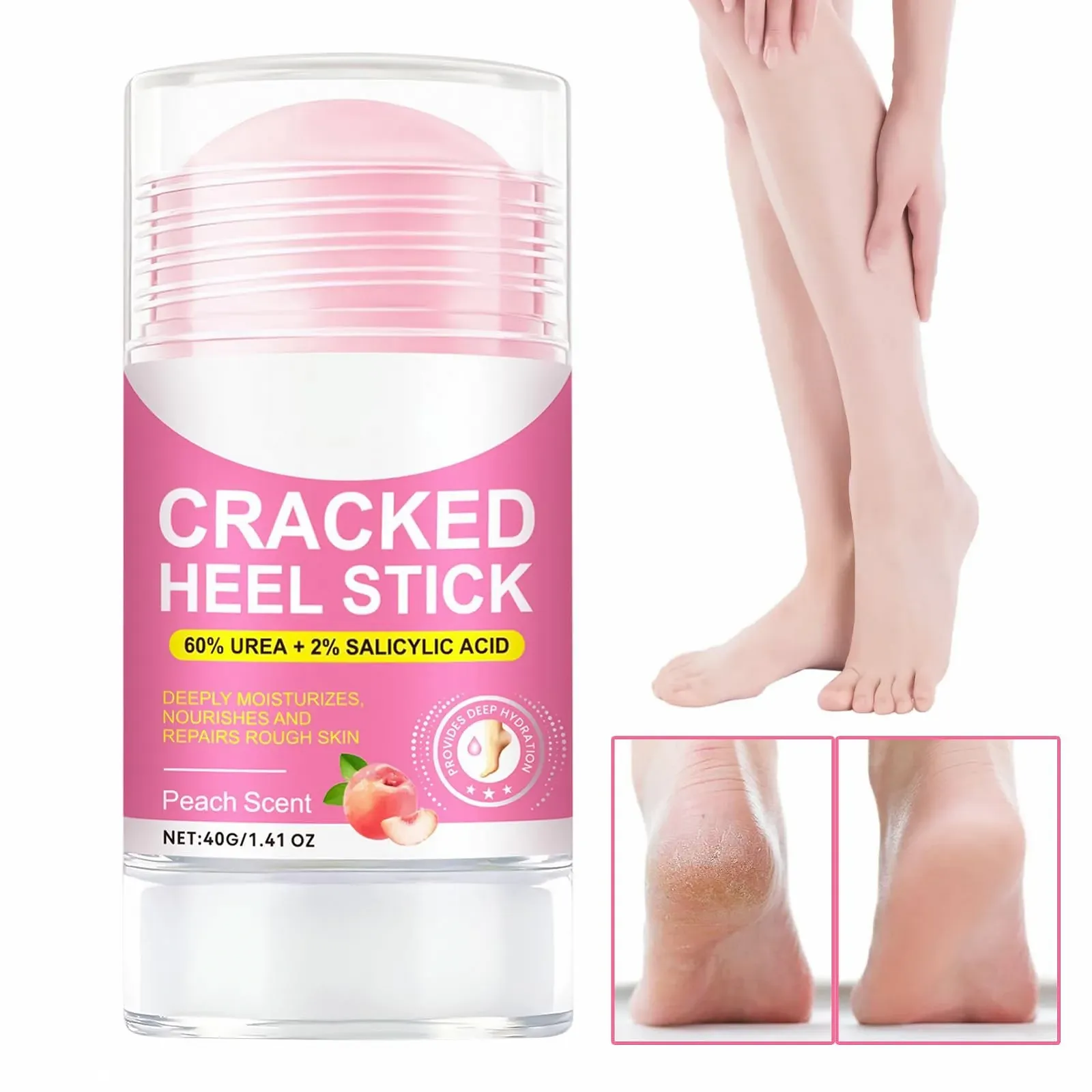 Крем для ног роллер увлажняющий питательный 40 г, фото №9