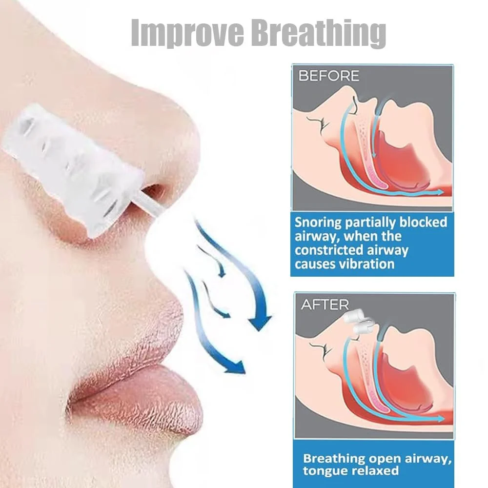 Розширювач для носа від хропіння, 8 шт, Роздільник для носа, фото №3 Розширювач для носа від хропіння, 8 шт, Роздільник для носа, фото №3