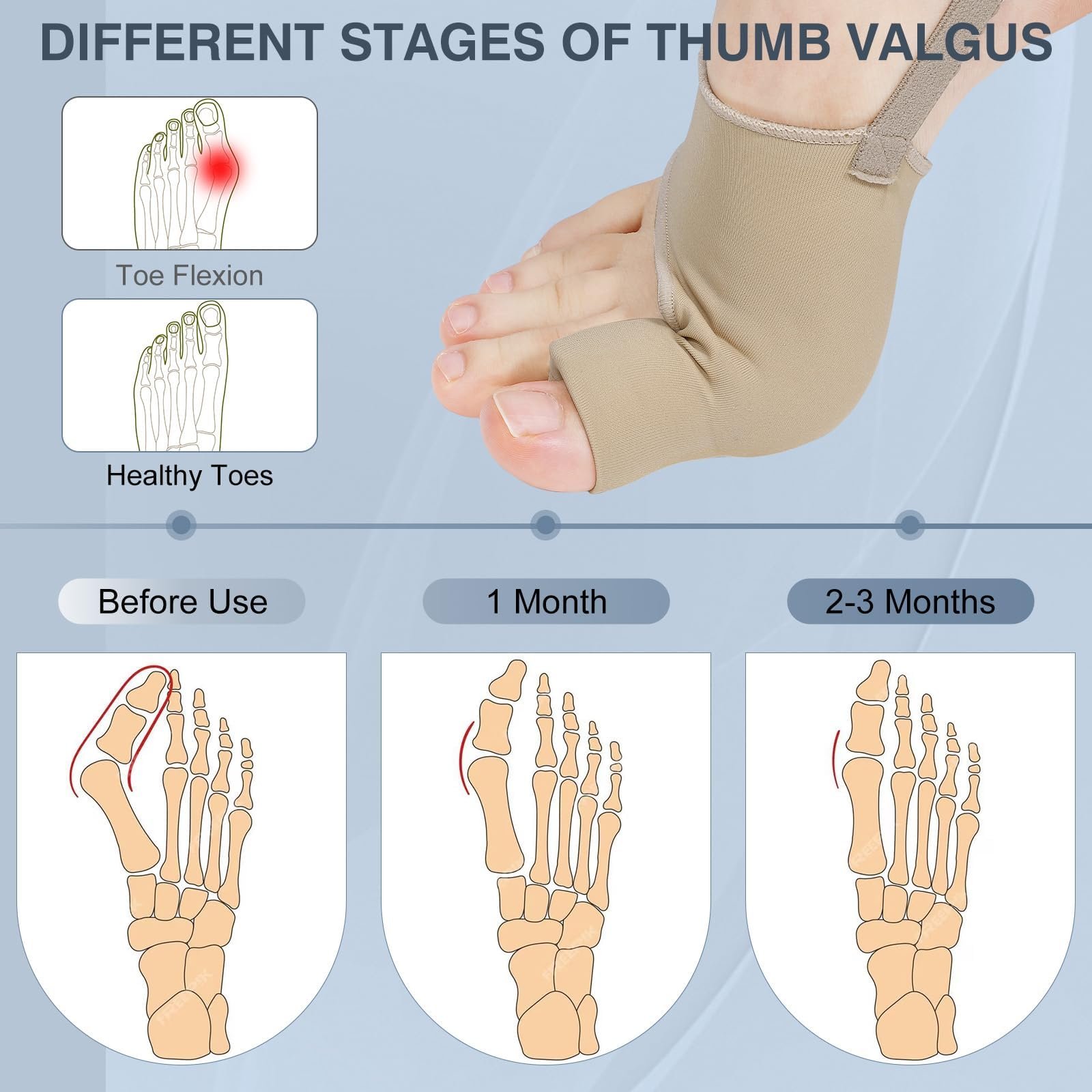 Коректор Вальгусної Деформації Для Чоловіків та Жінок, фото №6 Коректор Вальгусної Деформації Для Чоловіків та Жінок, фото №6
