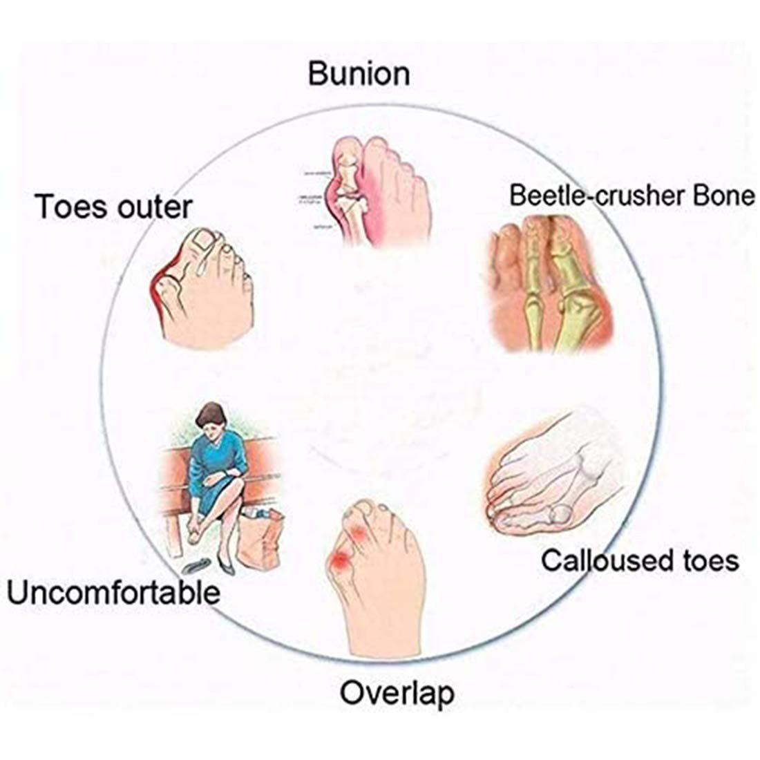 Удобные Шлепанцы для Женщин Плоские, Ортопедические, фото №5