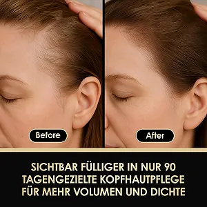 Сироватка для волосся ThickTails Root Stimulating Leave-In - 100 мл | Зміцнює, живить і відновлює synthetic.ua - Фото 1