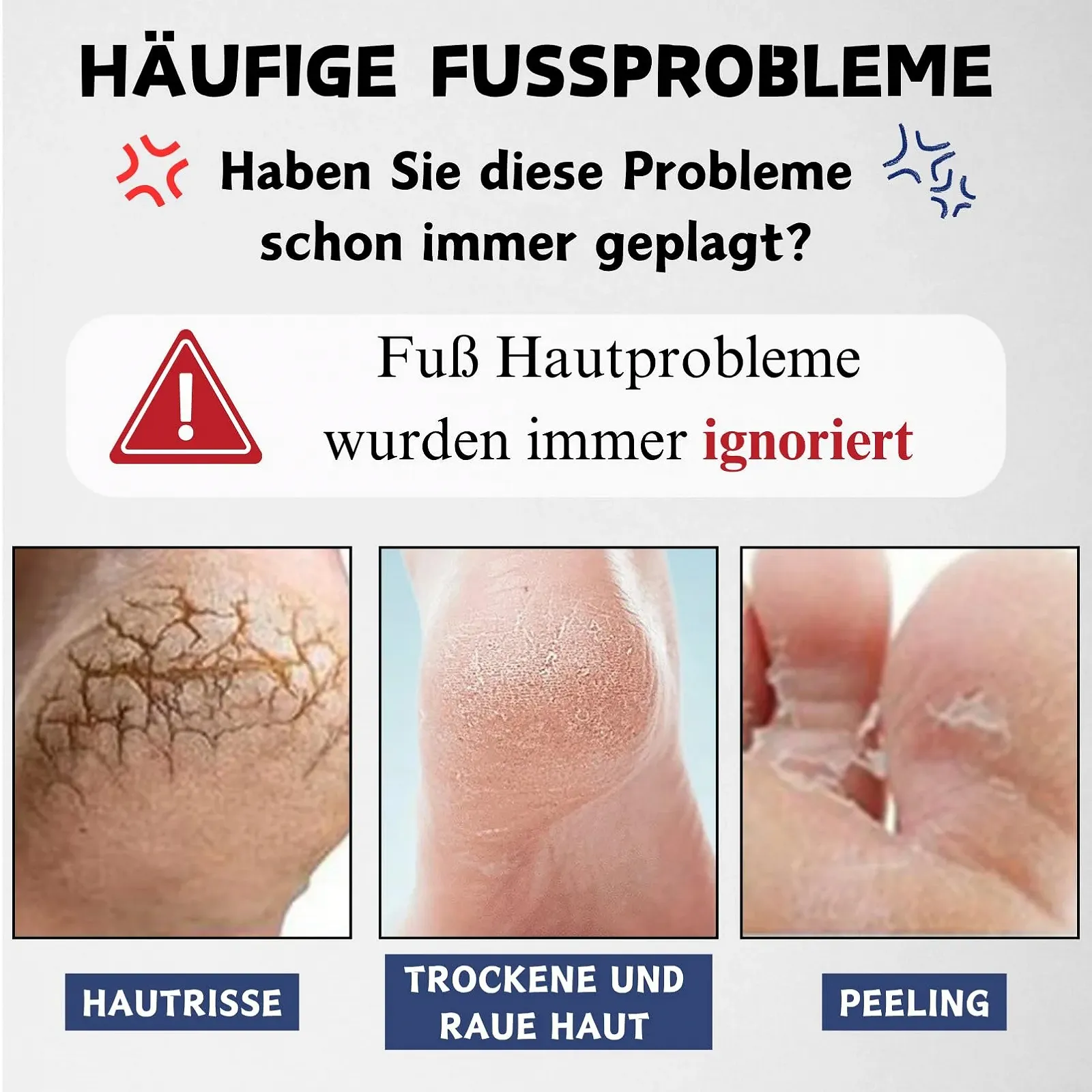 Крем для ног Urea 40% против мозолей и трещин интенсивно увлажняющий 150 г, фото №6