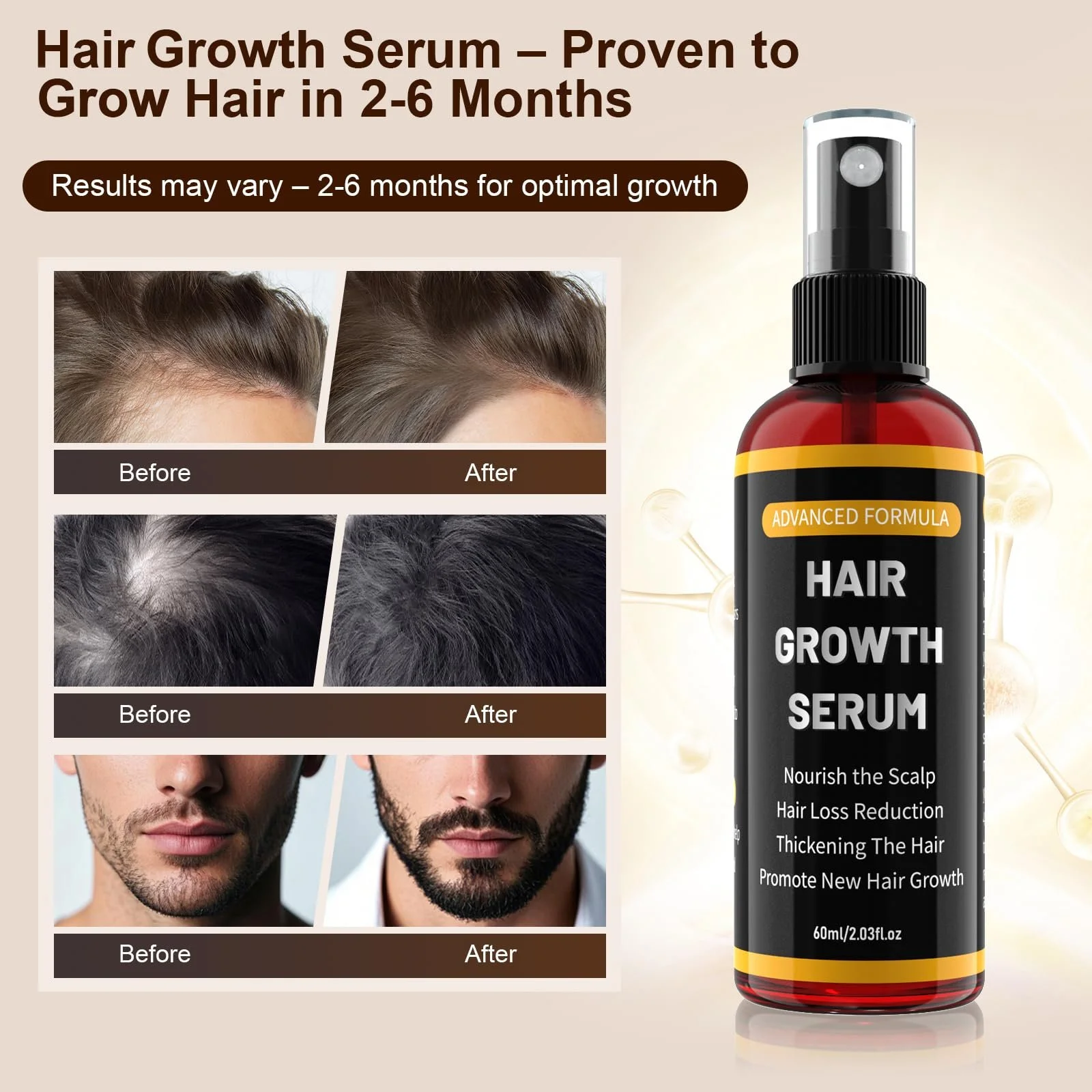 Спрей для роста волос Aisisree 5% для мужчин и женщин - Смесь розмаринового и касторового масла для истонченных волос, легкий и нежирный, 60 мл, фото №2 Спрей для роста волос Aisisree 5% для мужчин и женщин - Смесь розмаринового и касторового масла для истонченных волос, легкий и нежирный, 60 мл, фото №2