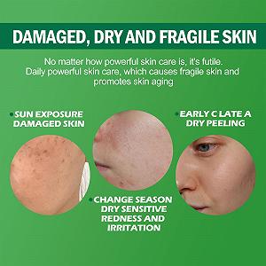 Маска для лица пенная очищающая с авокадо, для глубокого очищения, для удаления черных точек, для очищения пор и омоложения кожи, 24 шт synthetic.ua - Фото 1