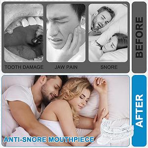 Засіб від хропіння, Прозора шина Регульована synthetic.ua - Фото 1