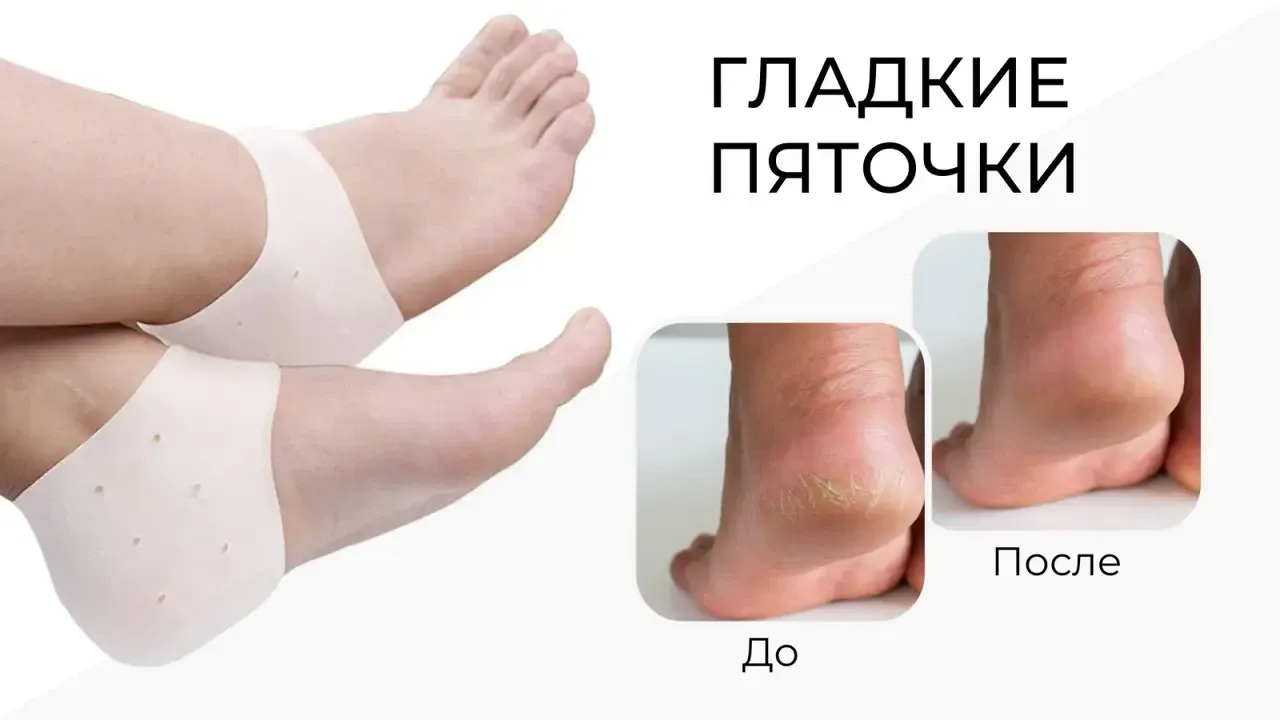 Протектор на пятку для взрослых Valgus Pro with hole 2шт White 16375, фото №2