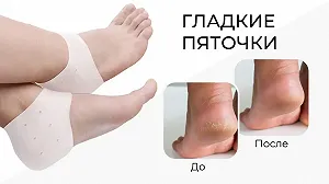 Протектор на пятку для взрослых Valgus Pro with hole 2шт White 16375 synthetic.ua - Фото 1